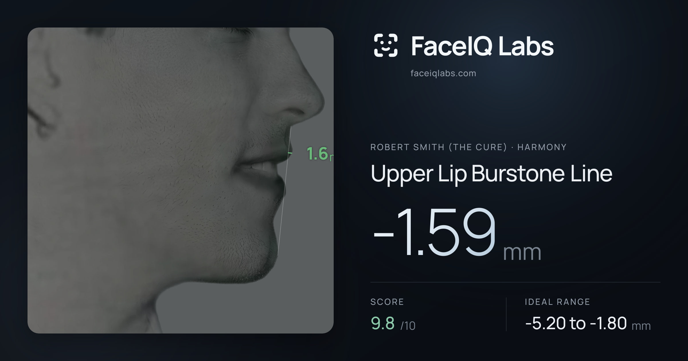 Robert Smith (The cure) Upper Lip Burstone Line: -1.59mm, drawn on the photo