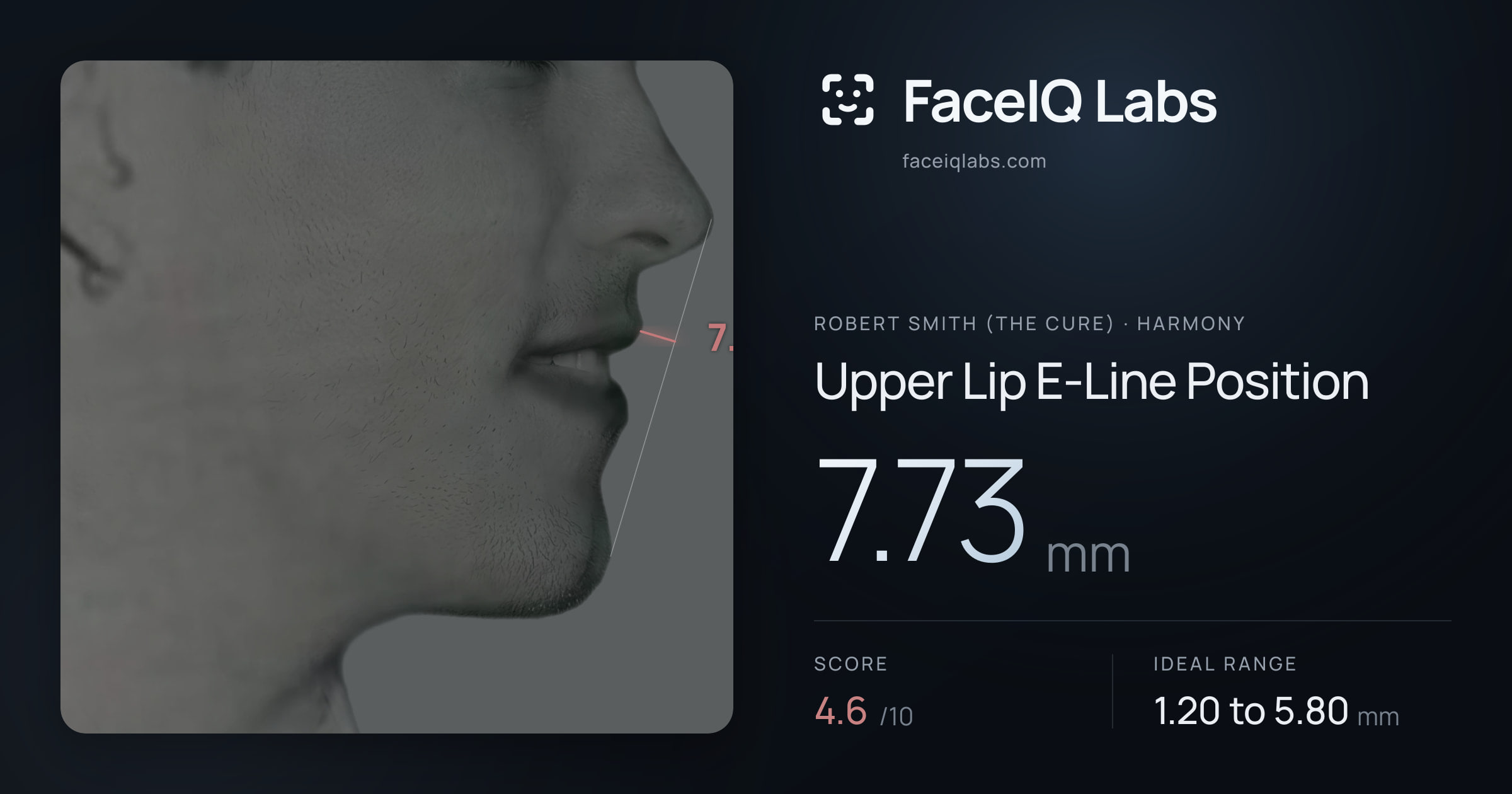 Robert Smith (The cure) Upper Lip E-Line Position: 7.73mm, drawn on the photo