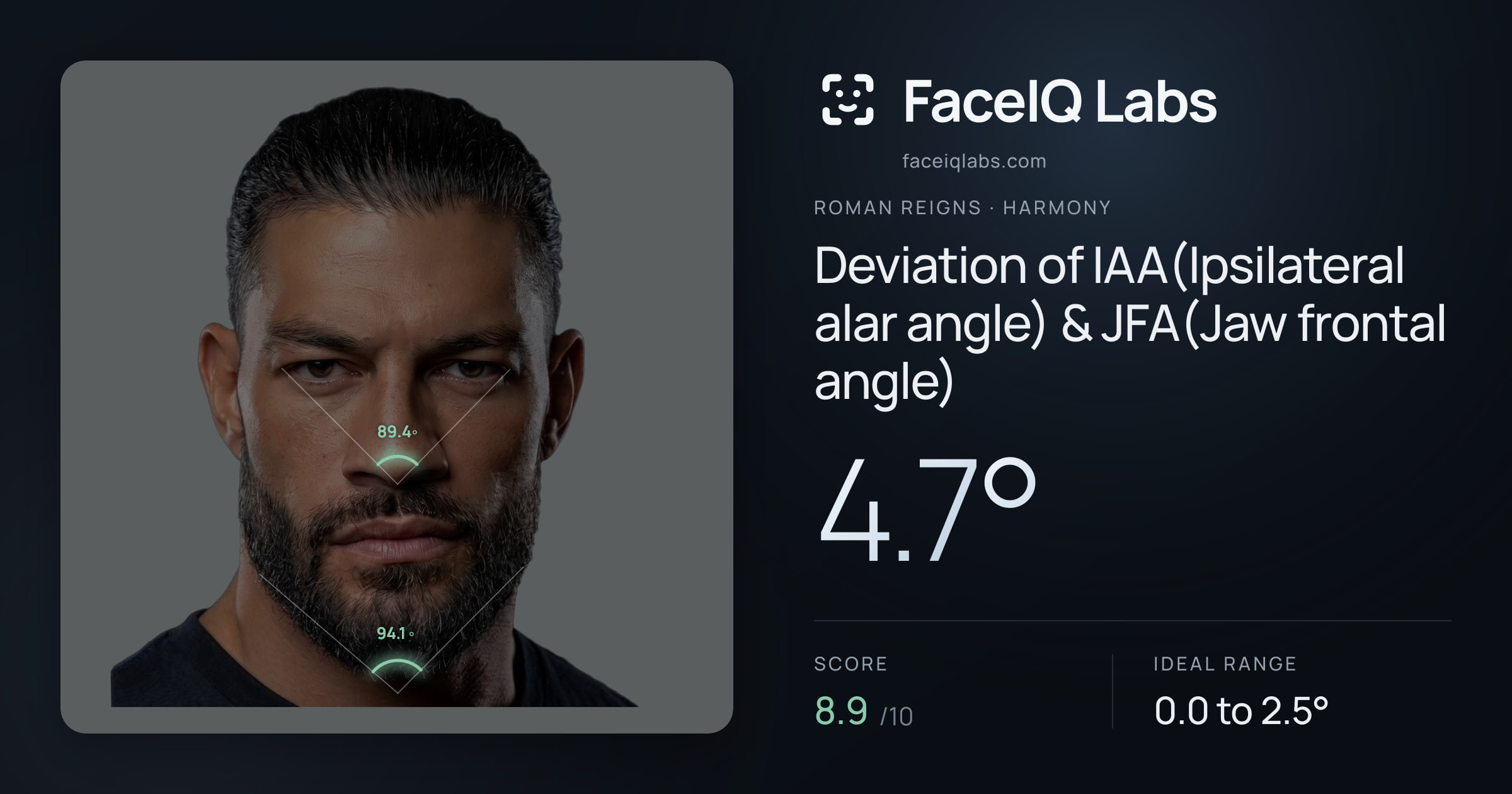 Roman Reigns Deviation of IAA(Ipsilateral alar angle) & JFA(Jaw frontal angle): 4.7°, drawn on the photo