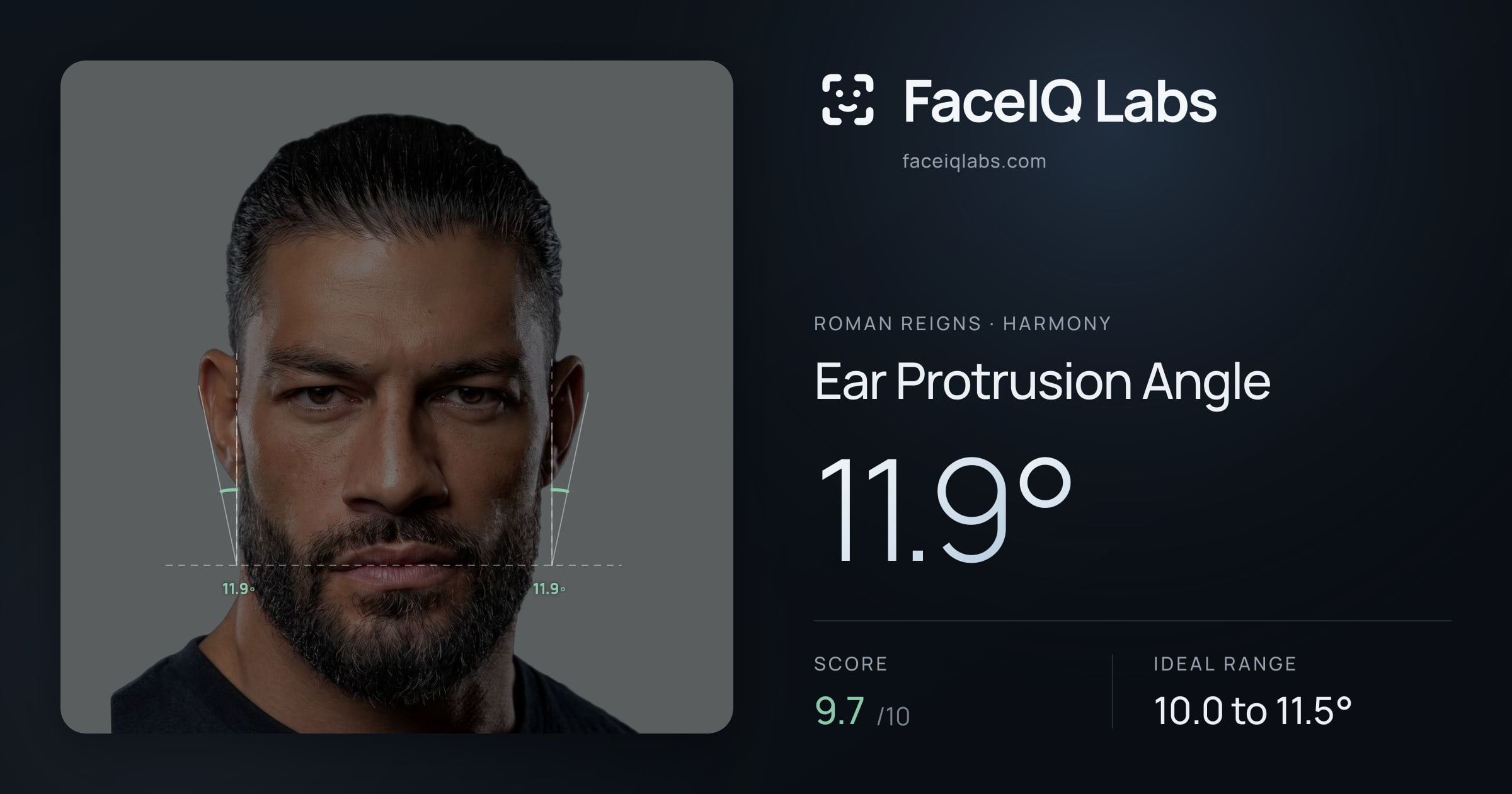 Roman Reigns Ear Protrusion Angle: 11.9°, drawn on the photo