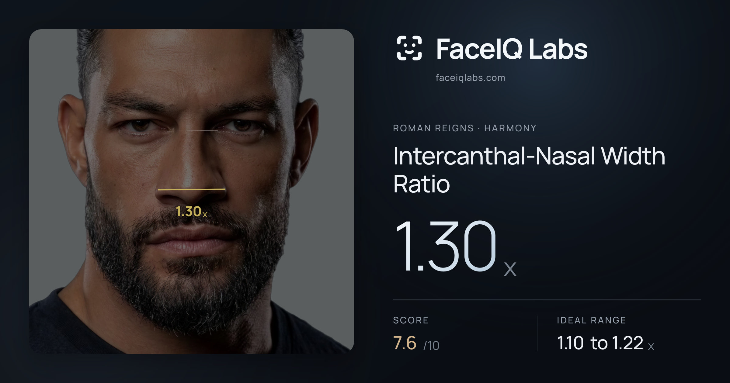 Roman Reigns Intercanthal-Nasal Width Ratio: 1.30x, drawn on the photo