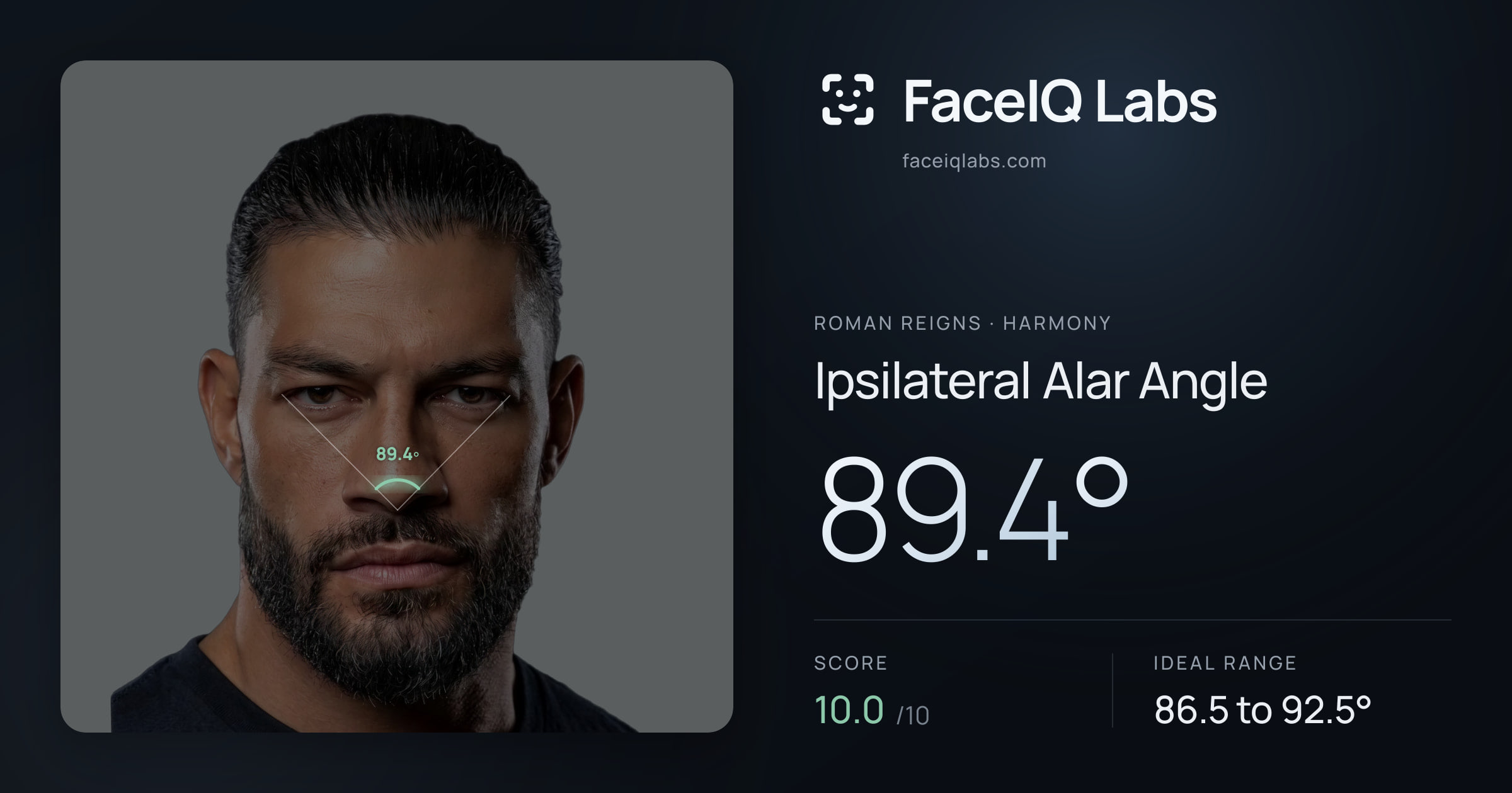 Roman Reigns Ipsilateral Alar Angle: 89.4°, drawn on the photo