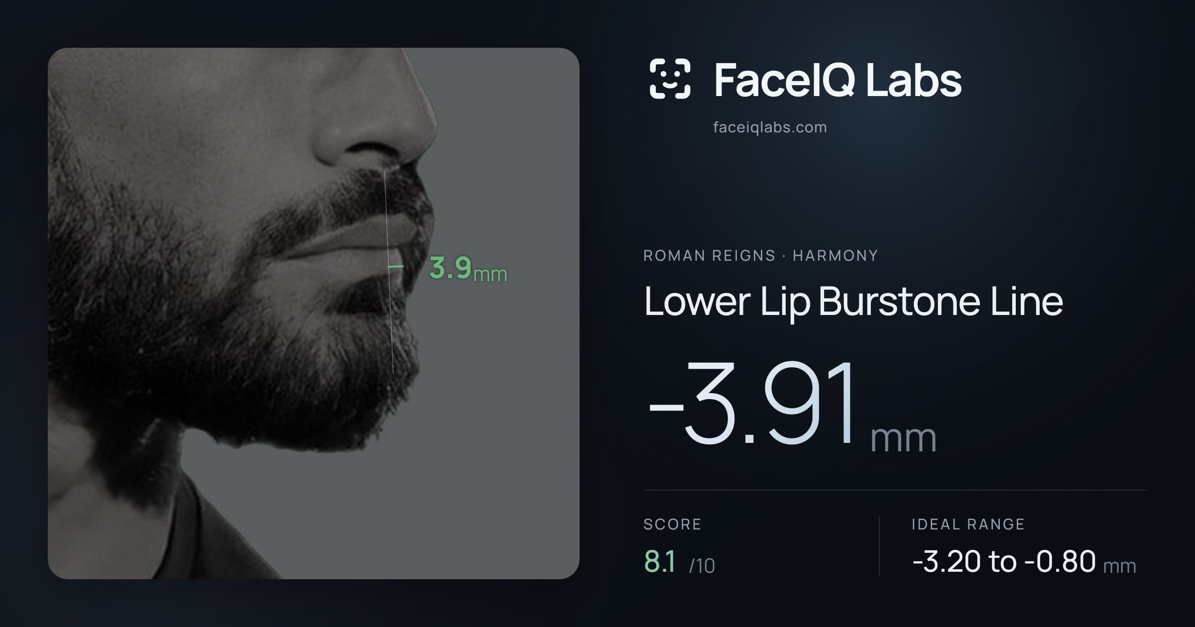 Roman Reigns Lower Lip Burstone Line: -3.91mm, drawn on the photo