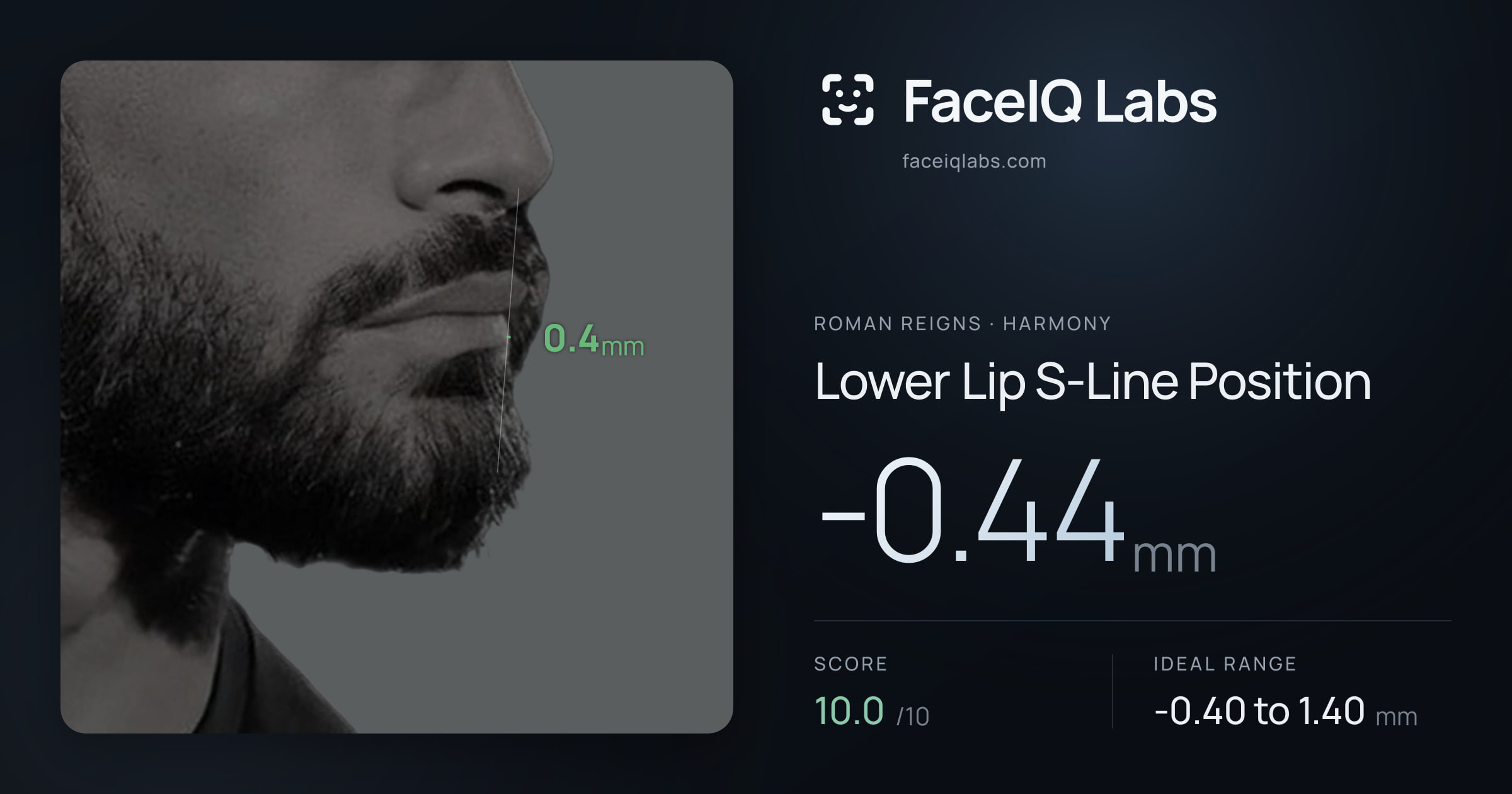 Roman Reigns Lower Lip S-Line Position: -0.44mm, drawn on the photo