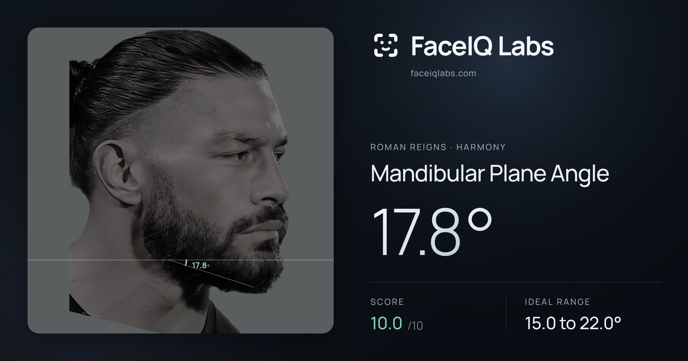 Roman Reigns Mandibular Plane Angle: 17.8°, drawn on the photo