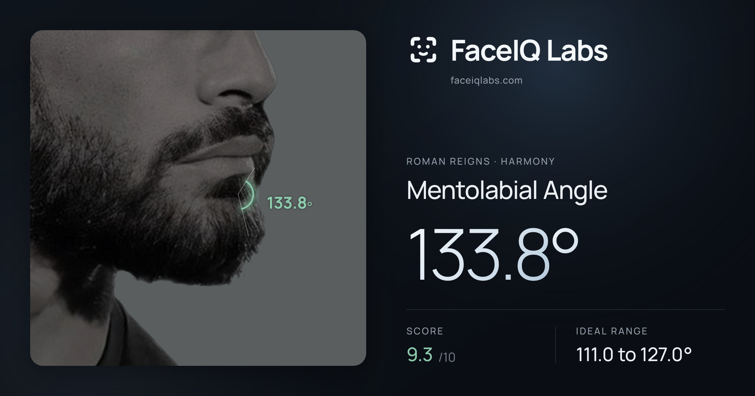 Roman Reigns Mentolabial Angle: 133.8°, drawn on the photo