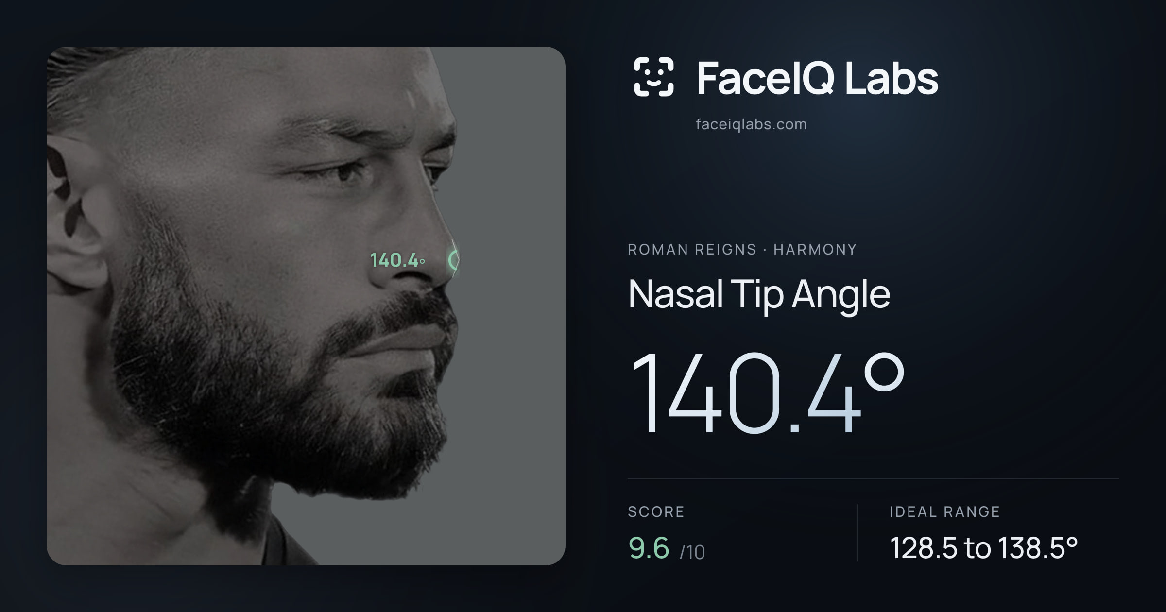 Roman Reigns Nasal Tip Angle: 140.4°, drawn on the photo