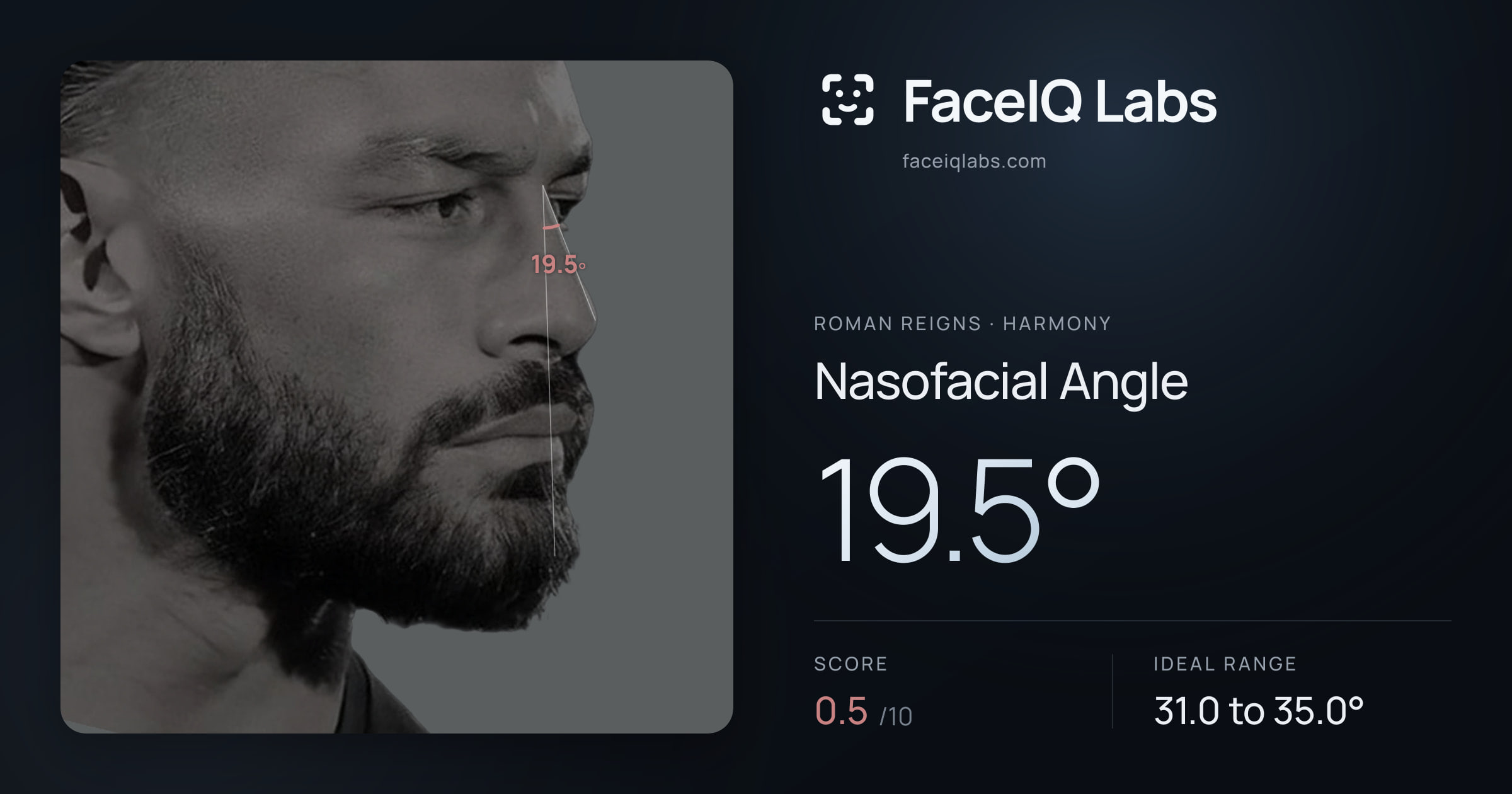 Roman Reigns Nasofacial Angle: 19.5°, drawn on the photo