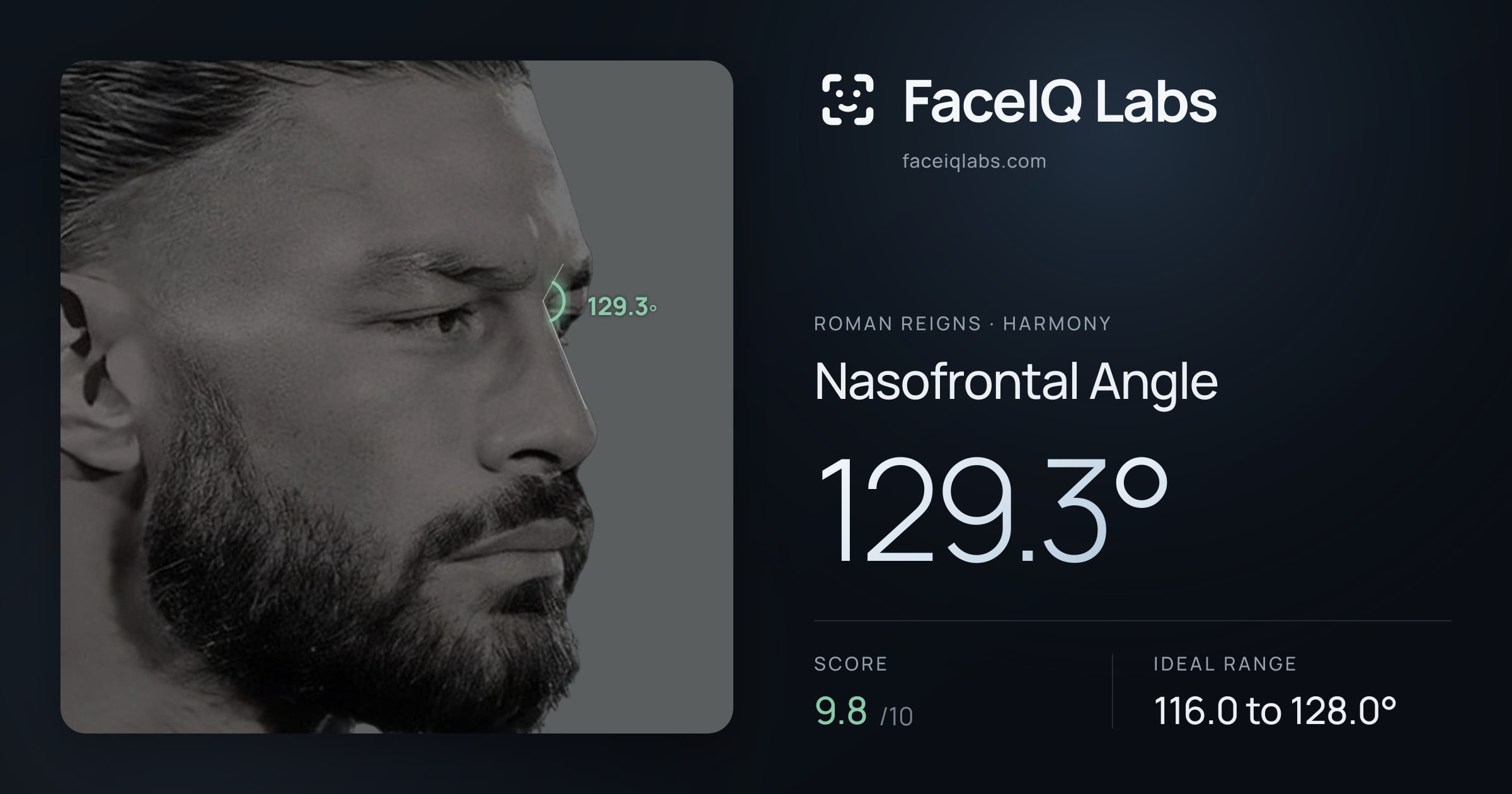 Roman Reigns Nasofrontal Angle: 129.3°, drawn on the photo