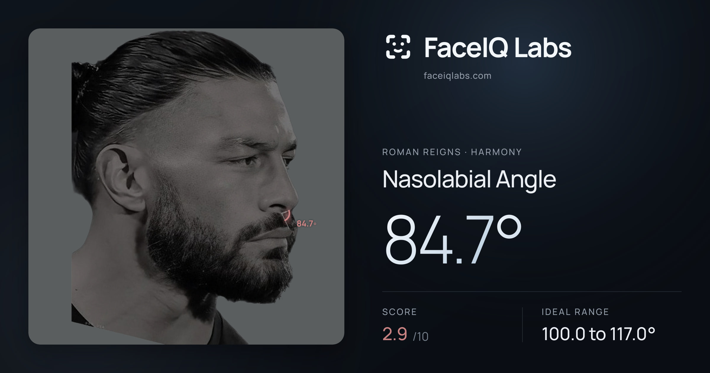 Roman Reigns Nasolabial Angle: 84.7°, drawn on the photo