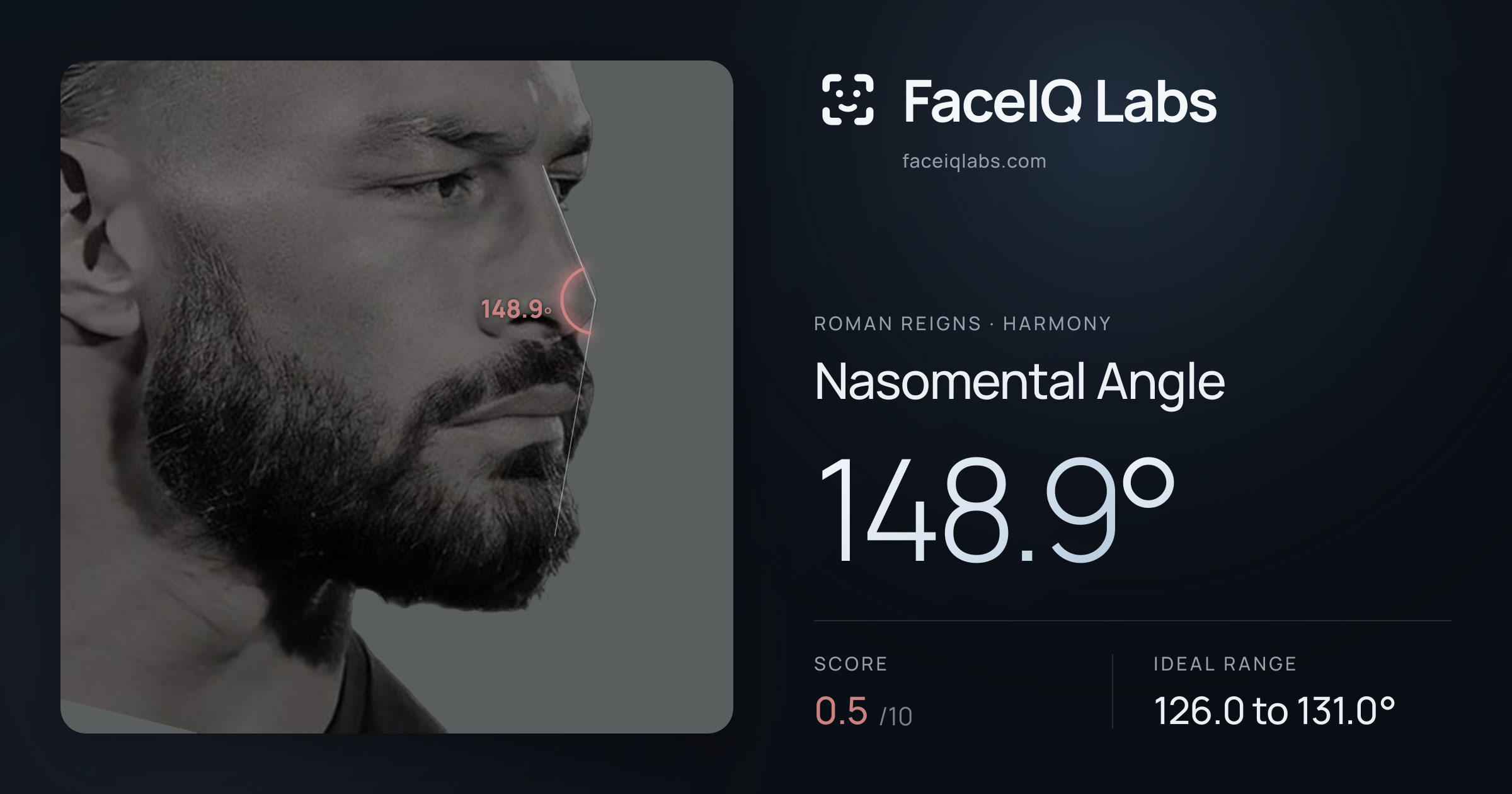 Roman Reigns Nasomental Angle: 148.9°, drawn on the photo