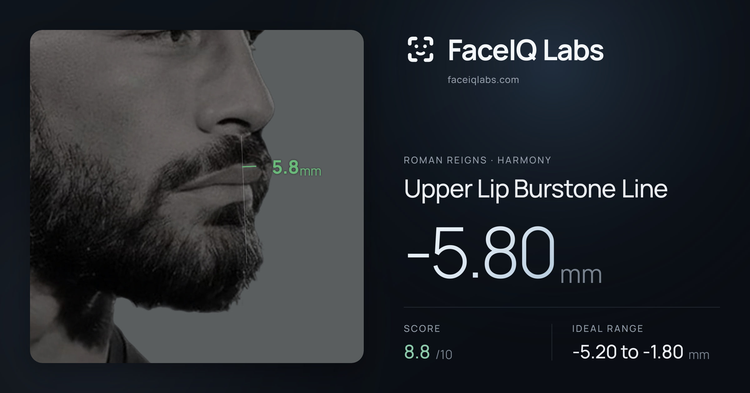 Roman Reigns Upper Lip Burstone Line: -5.80mm, drawn on the photo