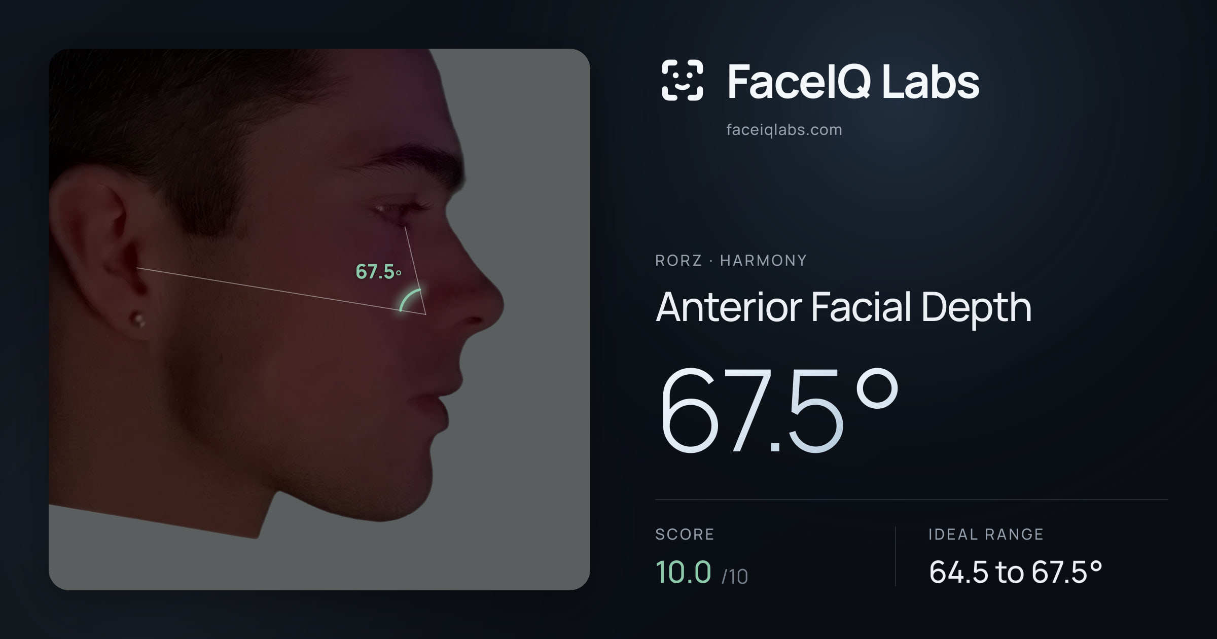 Rorz Anterior Facial Depth: 67.5°, drawn on the photo
