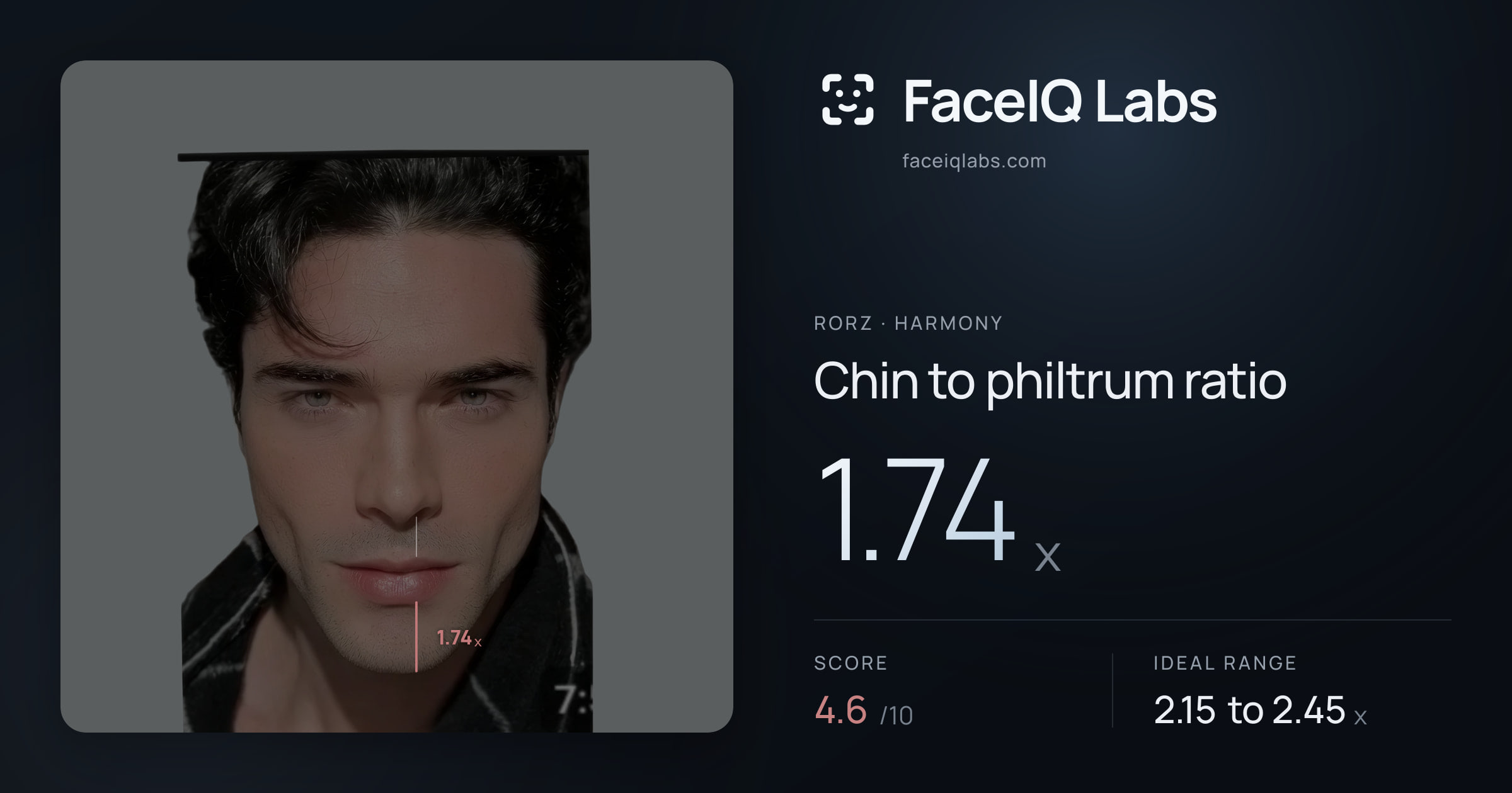 Rorz Chin to philtrum ratio: 1.74x, drawn on the photo