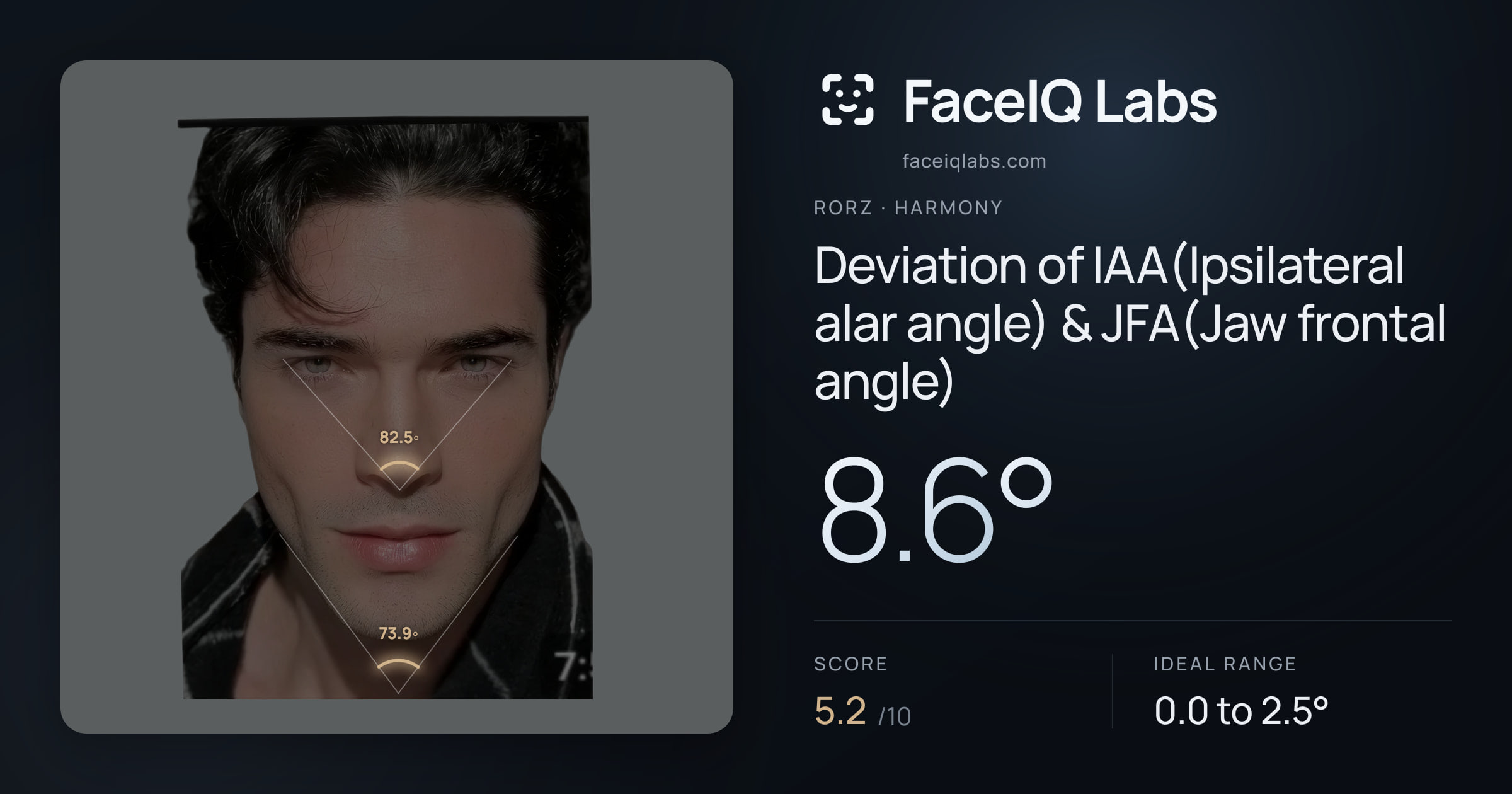 Rorz Deviation of IAA(Ipsilateral alar angle) & JFA(Jaw frontal angle): 8.6°, drawn on the photo