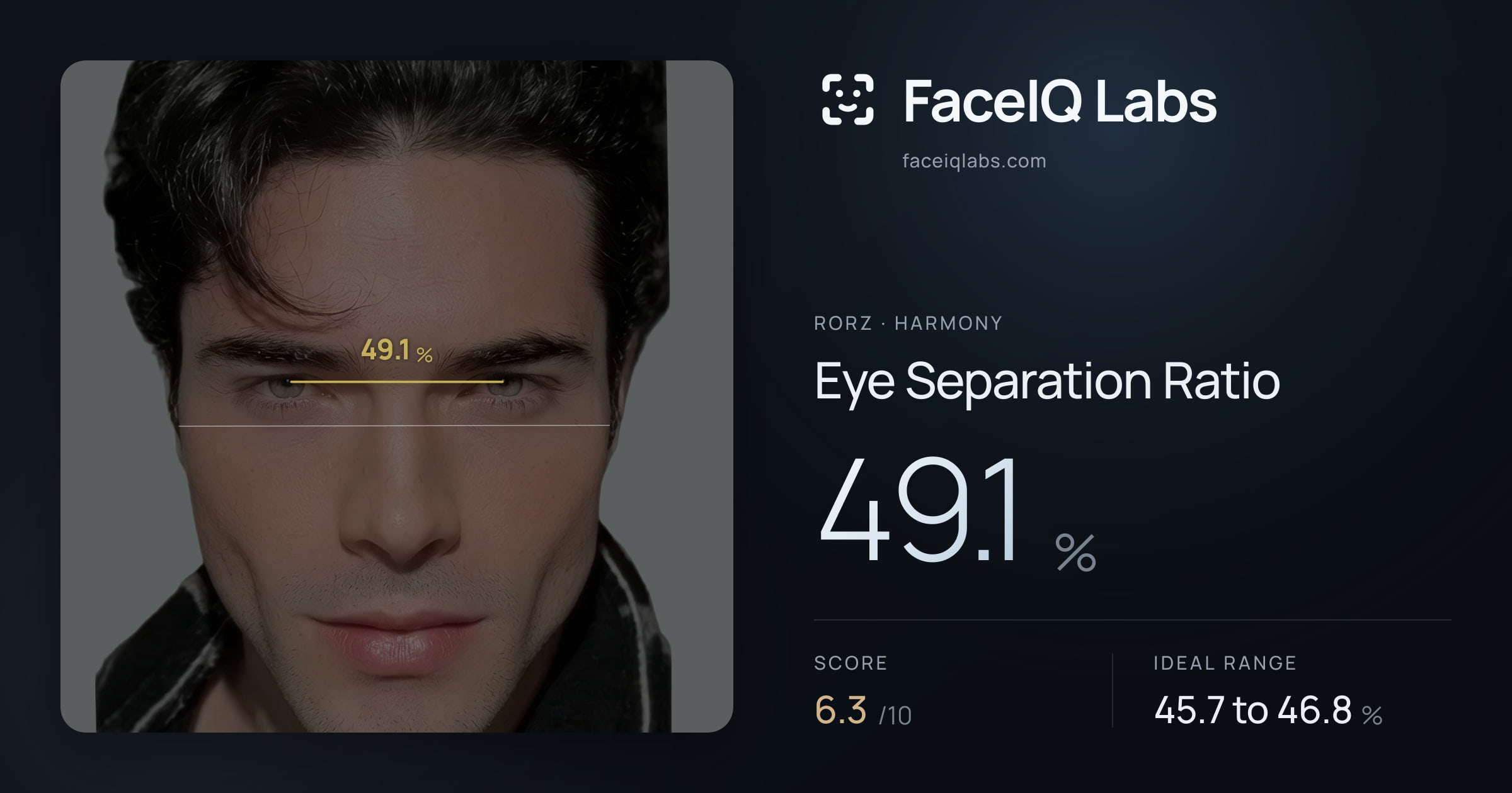 Rorz Eye Separation Ratio: 49.1%, drawn on the photo