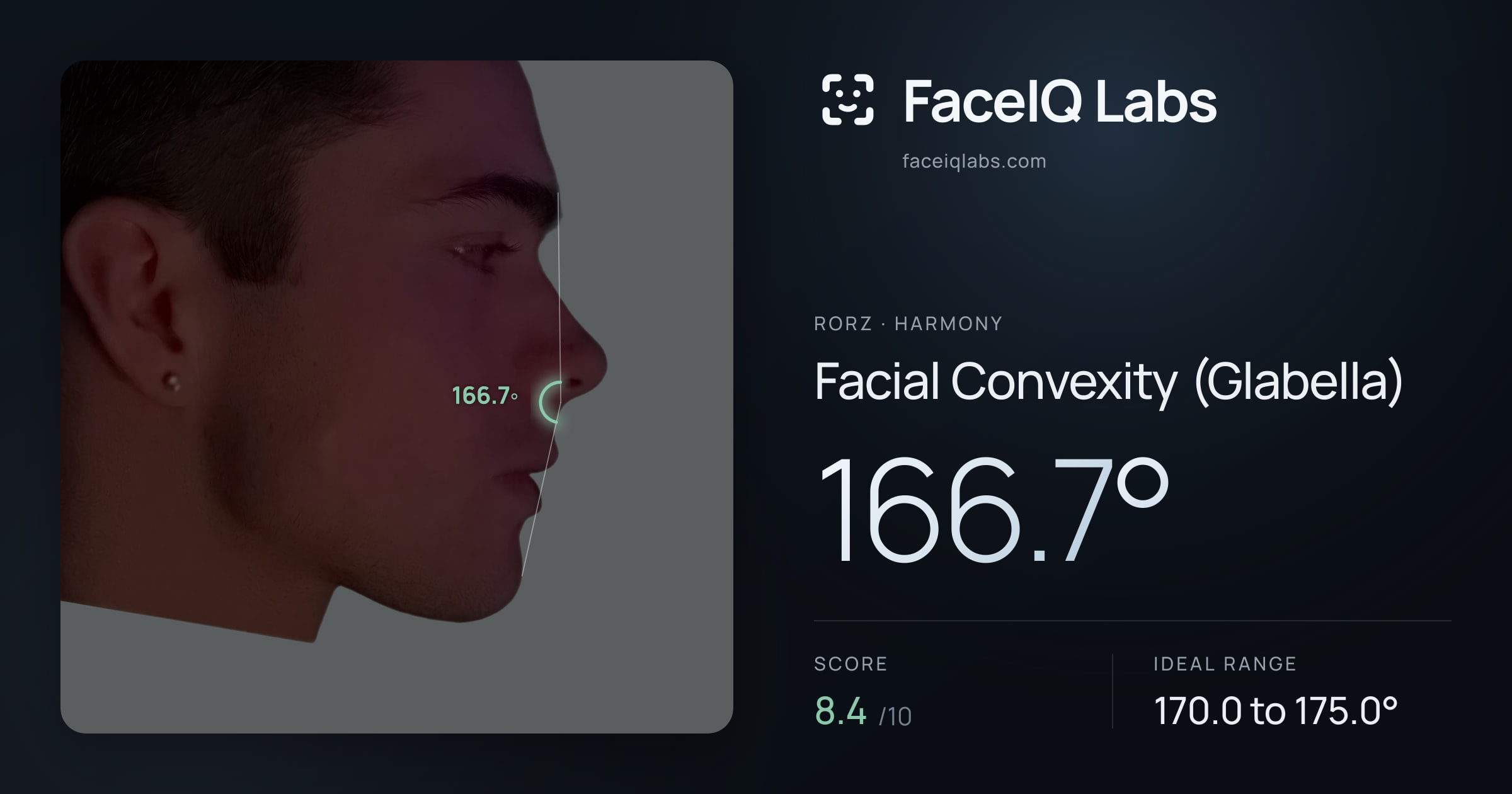Rorz Facial Convexity (Glabella): 166.7°, drawn on the photo