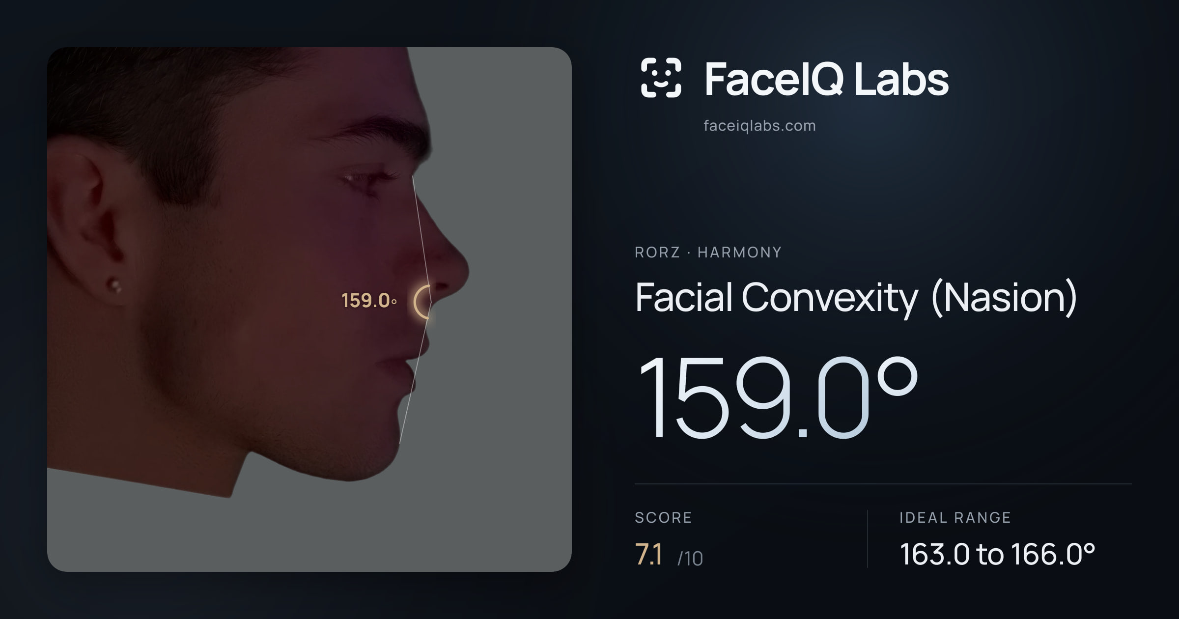Rorz Facial Convexity (Nasion): 159.0°, drawn on the photo