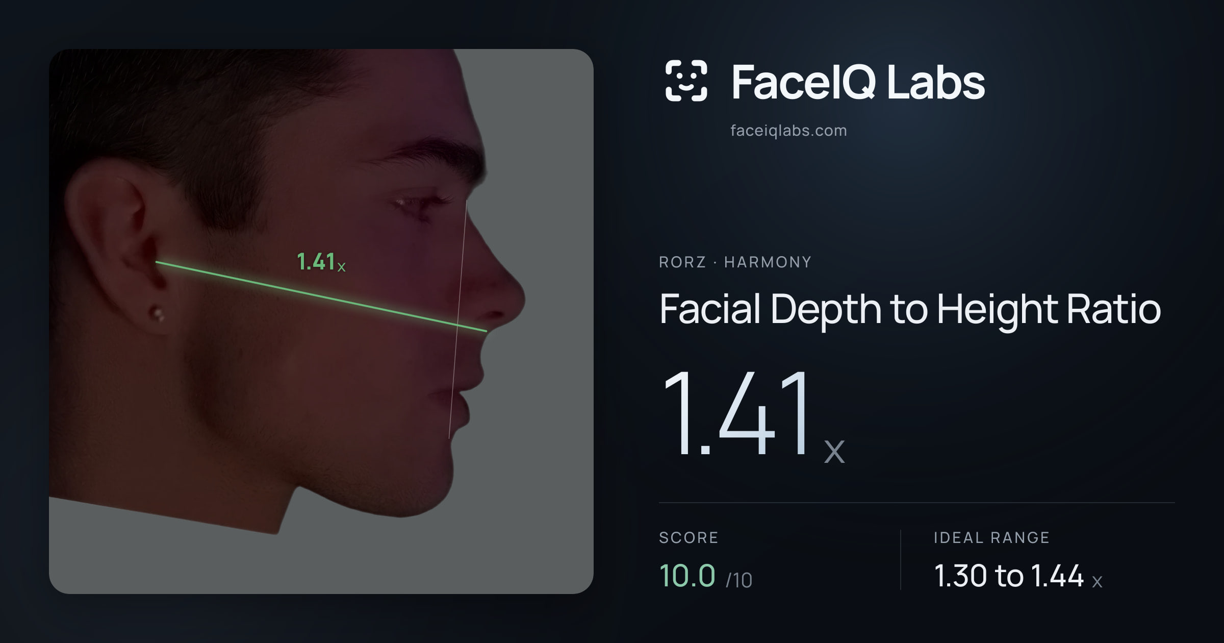 Rorz Facial Depth to Height Ratio: 1.41x, drawn on the photo