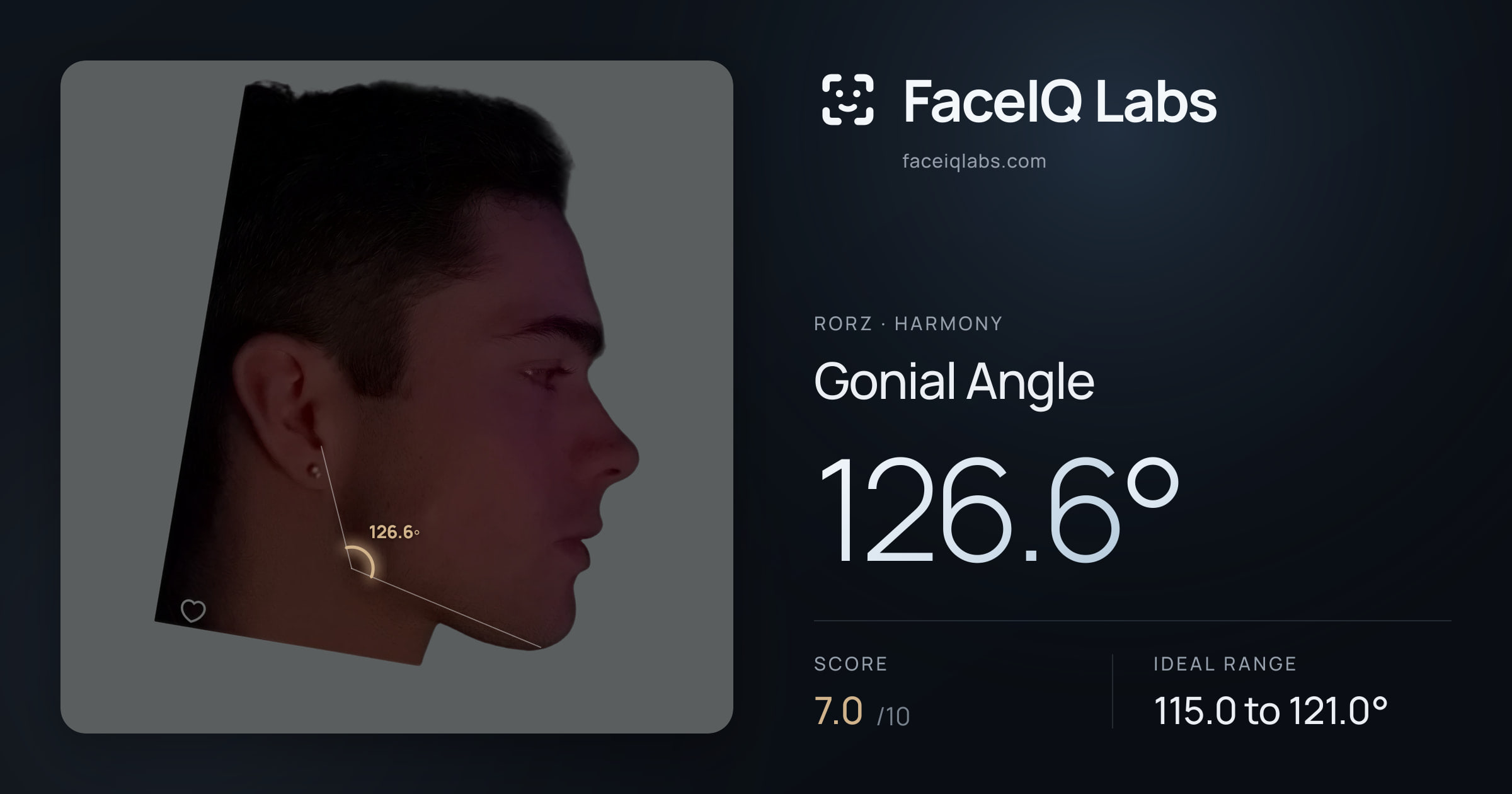 Rorz Gonial Angle: 126.6°, drawn on the photo
