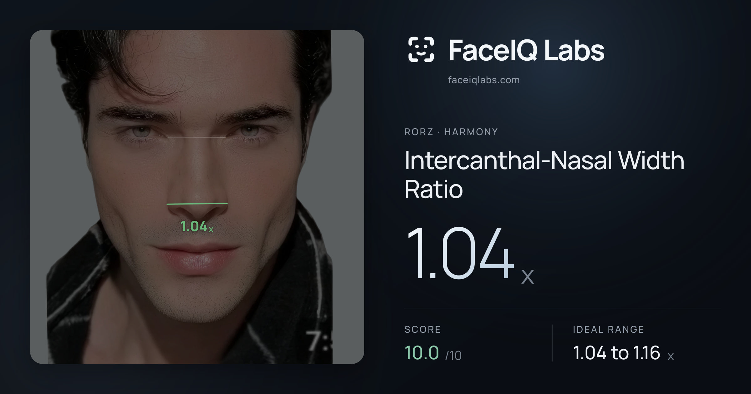 Rorz Intercanthal-Nasal Width Ratio: 1.04x, drawn on the photo