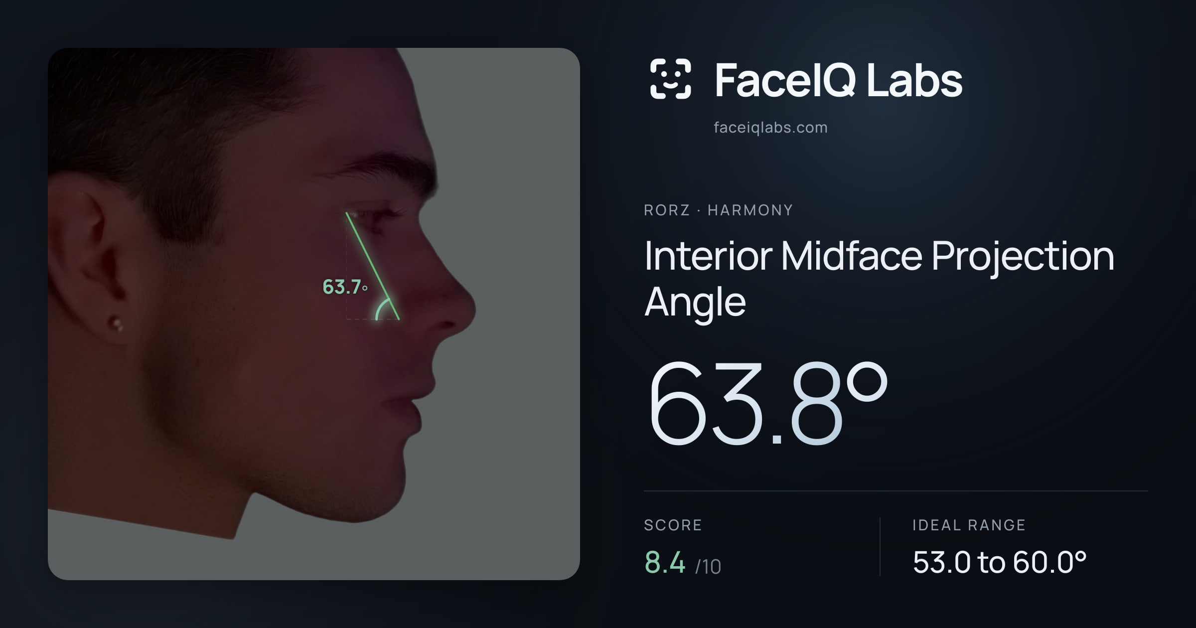 Rorz Interior Midface Projection Angle: 63.8°, drawn on the photo