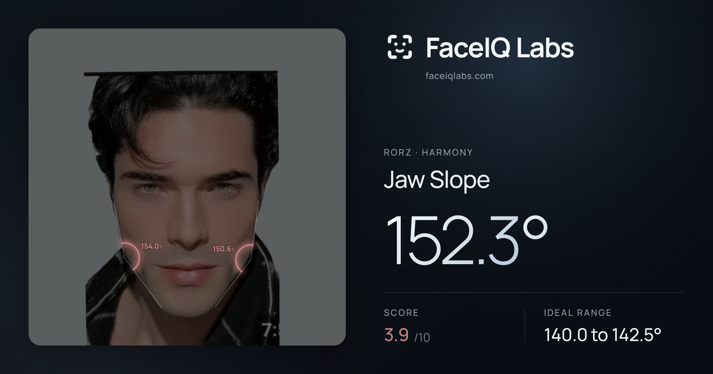 Rorz Jaw Slope: 152.3°, drawn on the photo