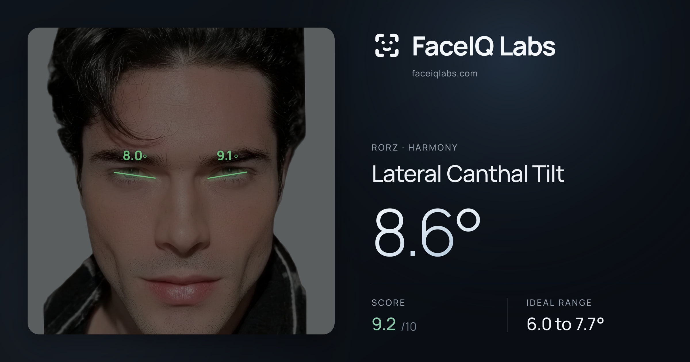 Rorz Lateral Canthal Tilt: 8.6°, drawn on the photo