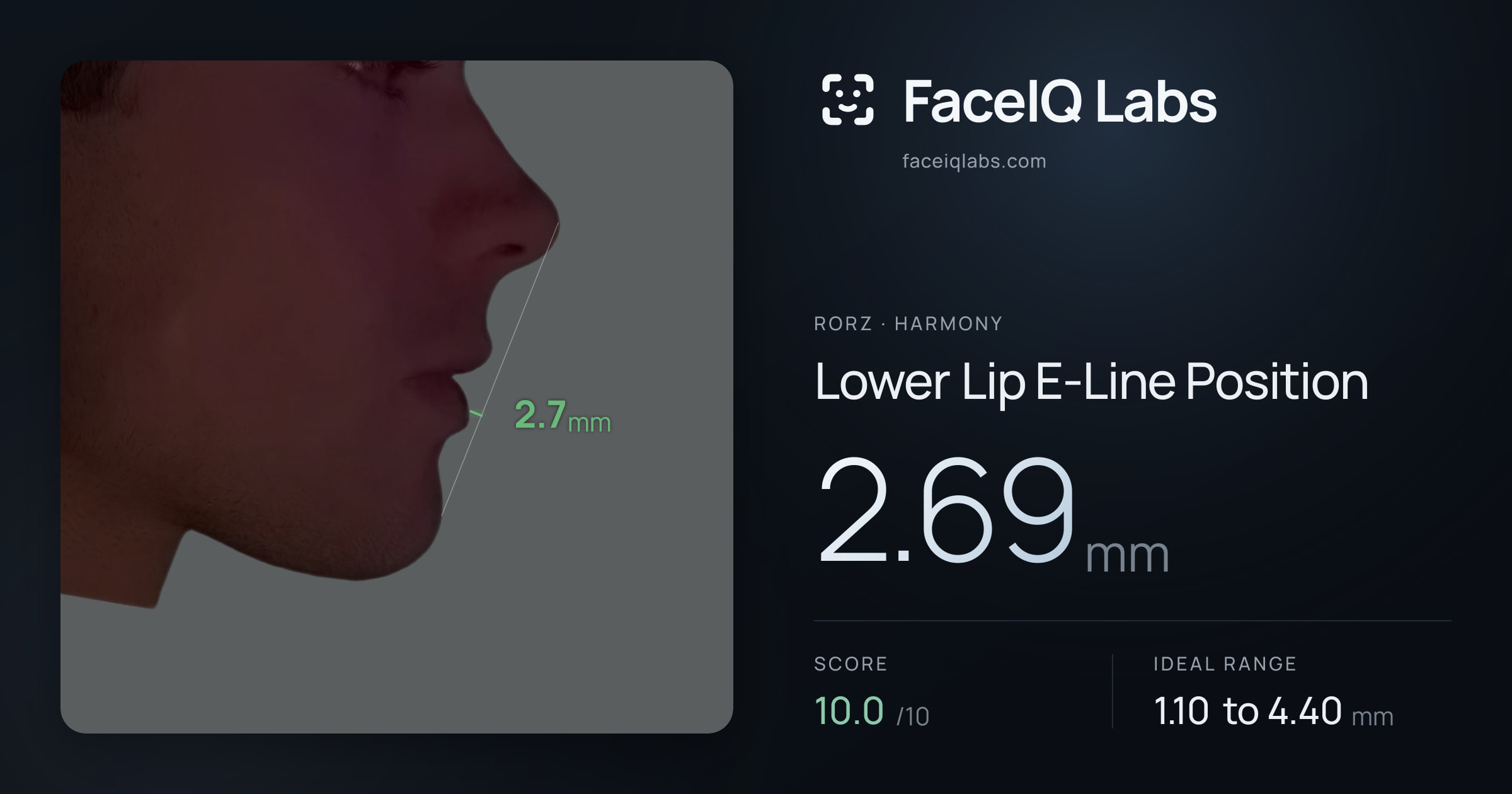 Rorz Lower Lip E-Line Position: 2.69mm, drawn on the photo