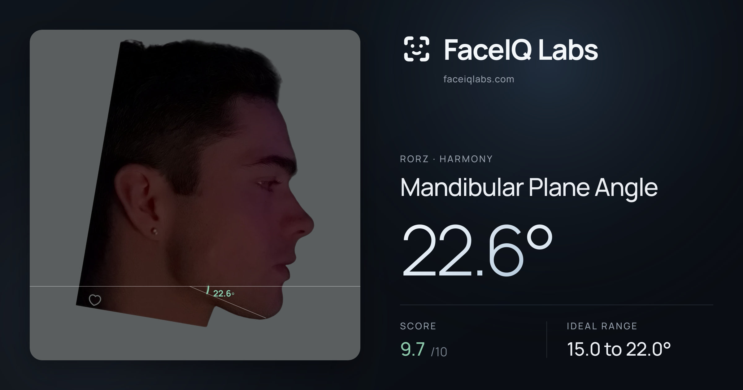 Rorz Mandibular Plane Angle: 22.6°, drawn on the photo