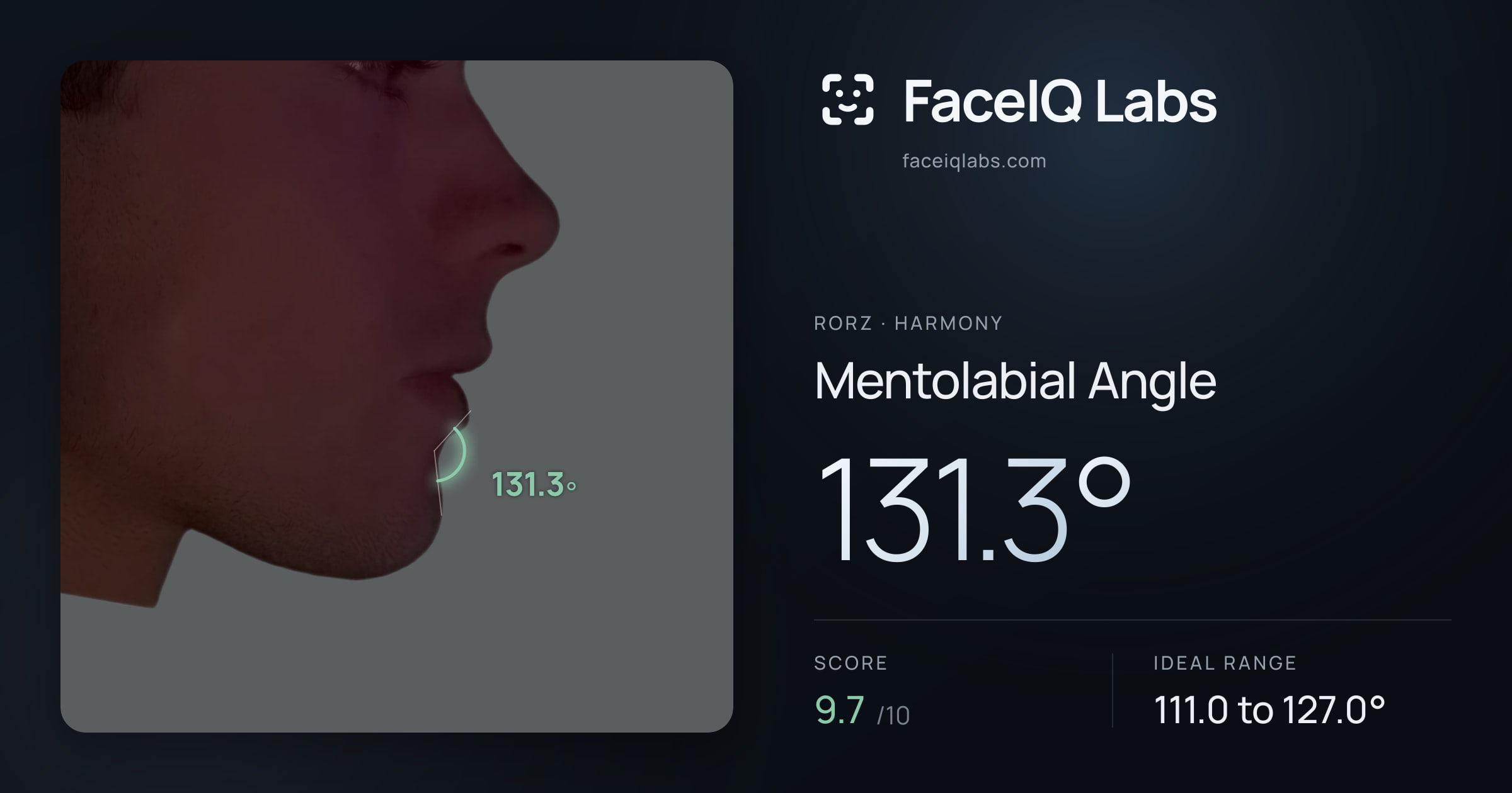 Rorz Mentolabial Angle: 131.3°, drawn on the photo