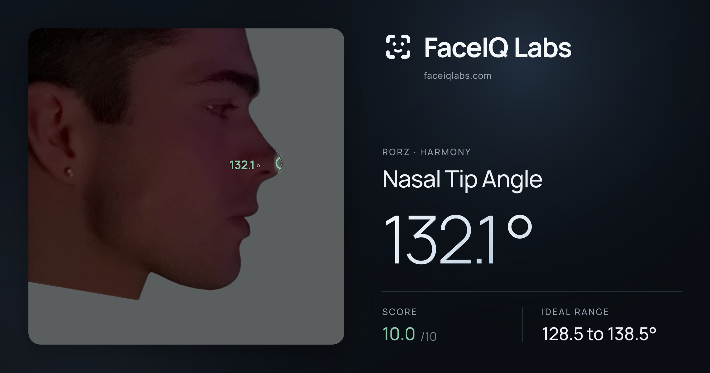 Rorz Nasal Tip Angle: 132.1°, drawn on the photo