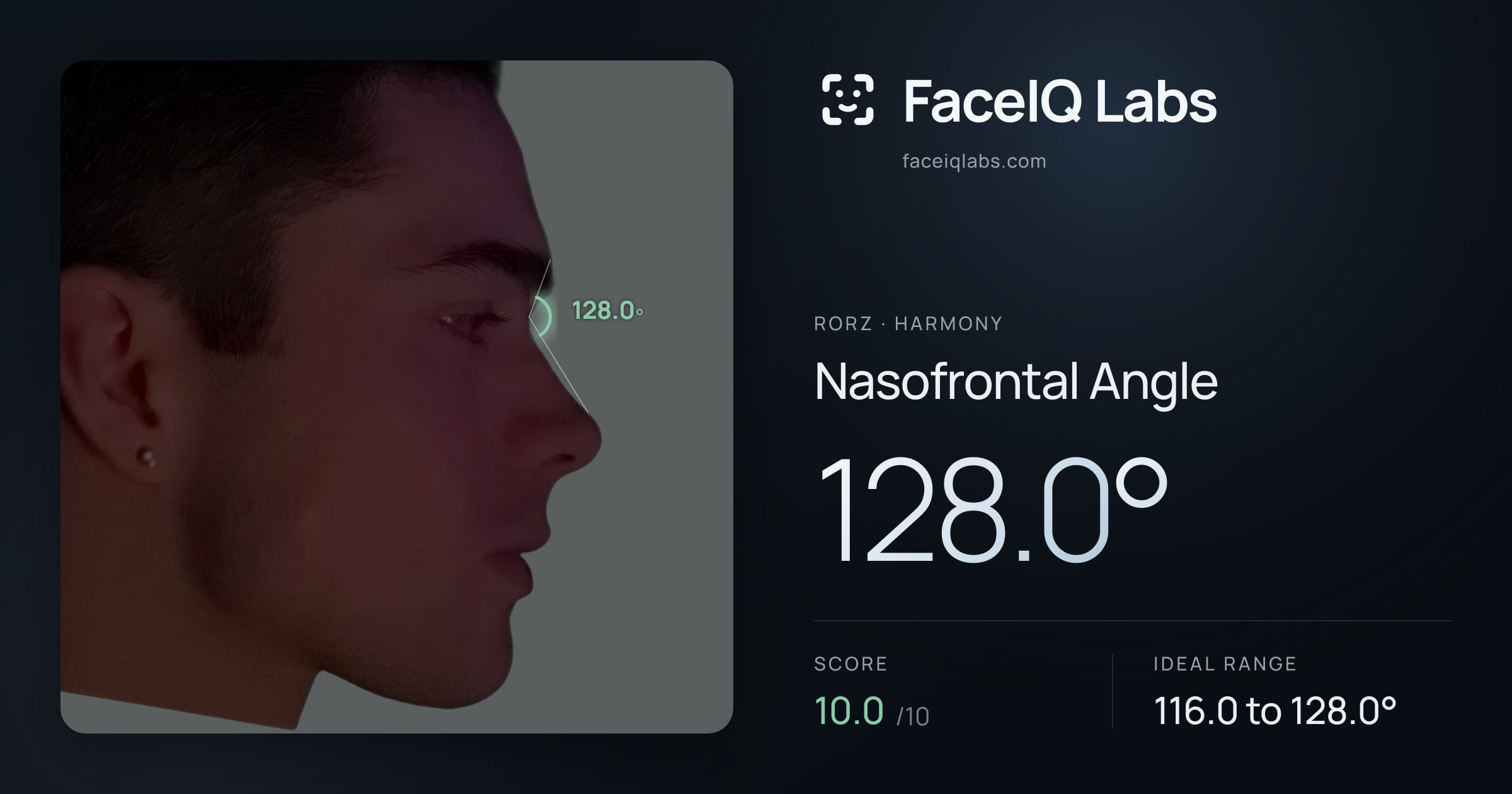 Rorz Nasofrontal Angle: 128.0°, drawn on the photo