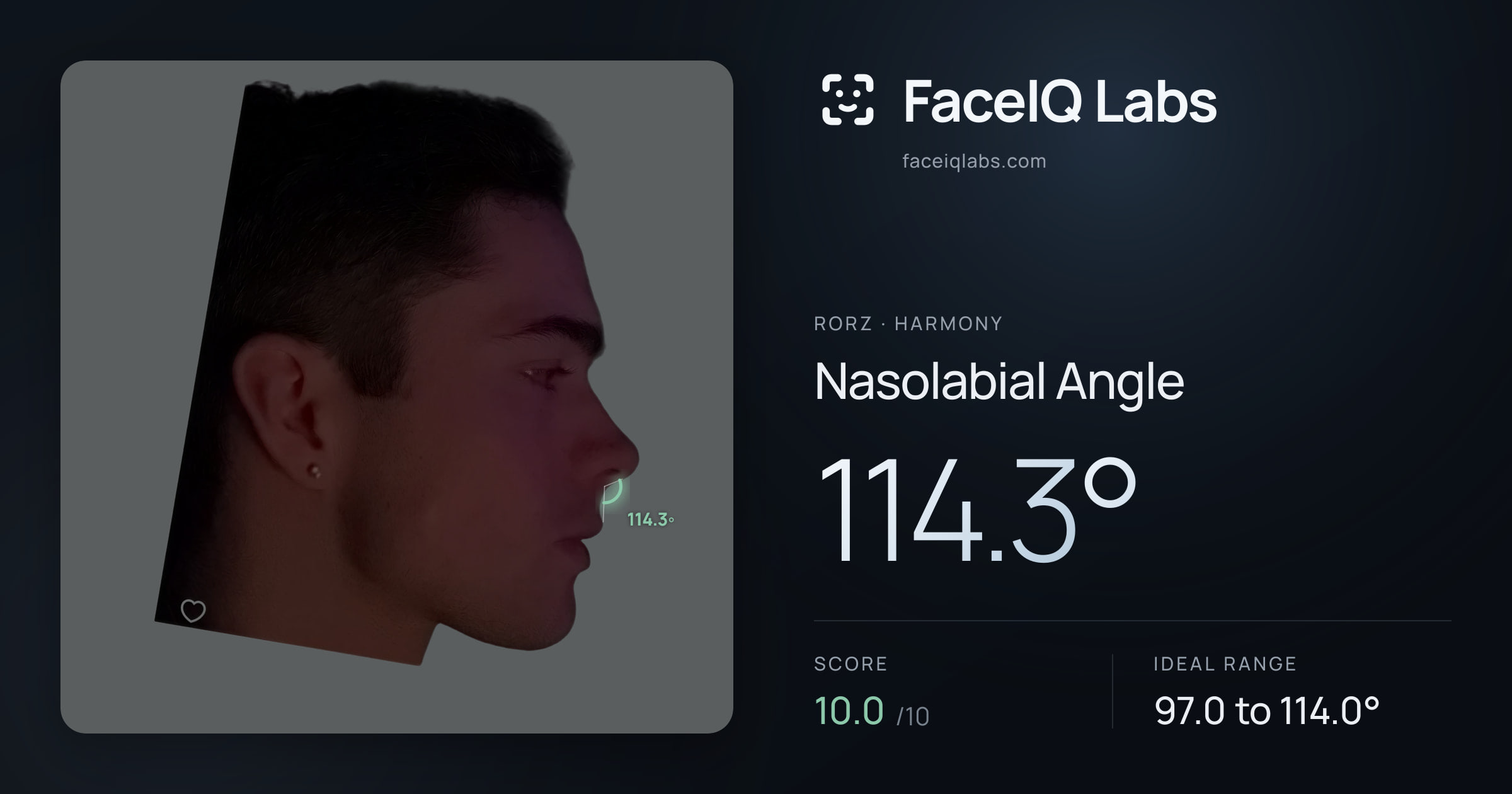 Rorz Nasolabial Angle: 114.3°, drawn on the photo