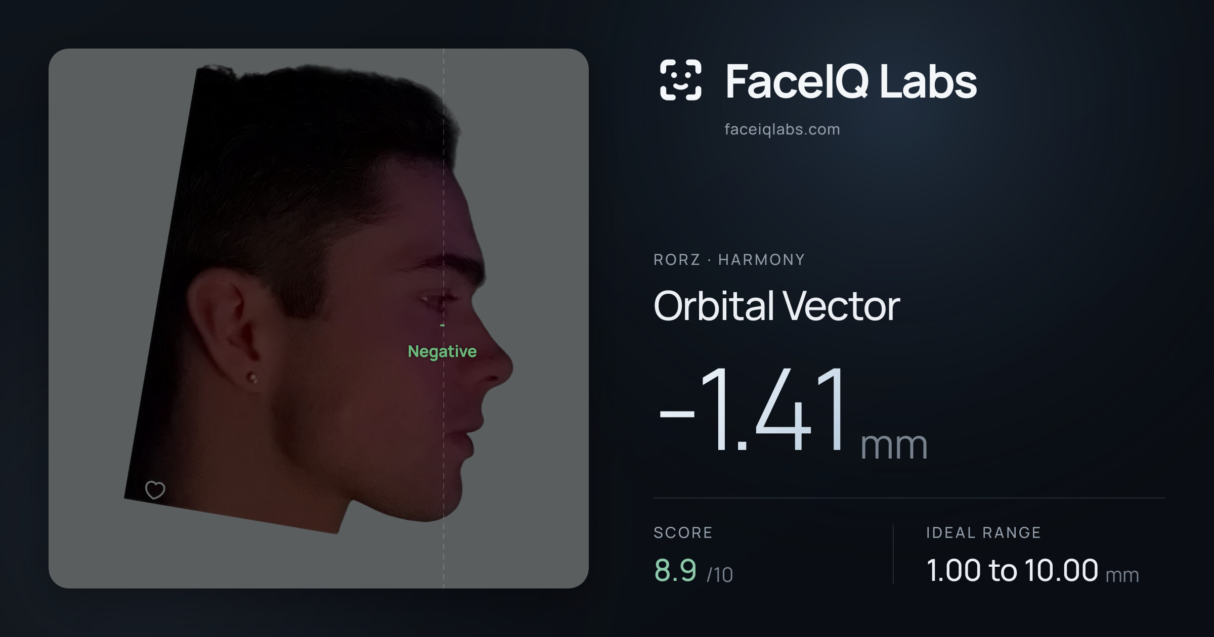 Rorz Orbital Vector: -1.41mm, drawn on the photo