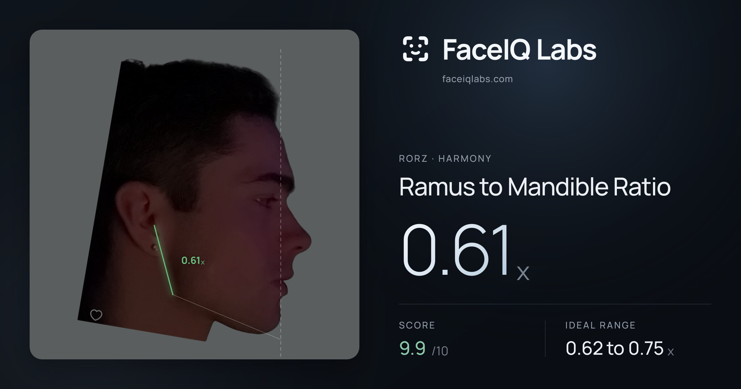 Rorz Ramus to Mandible Ratio: 0.61x, drawn on the photo