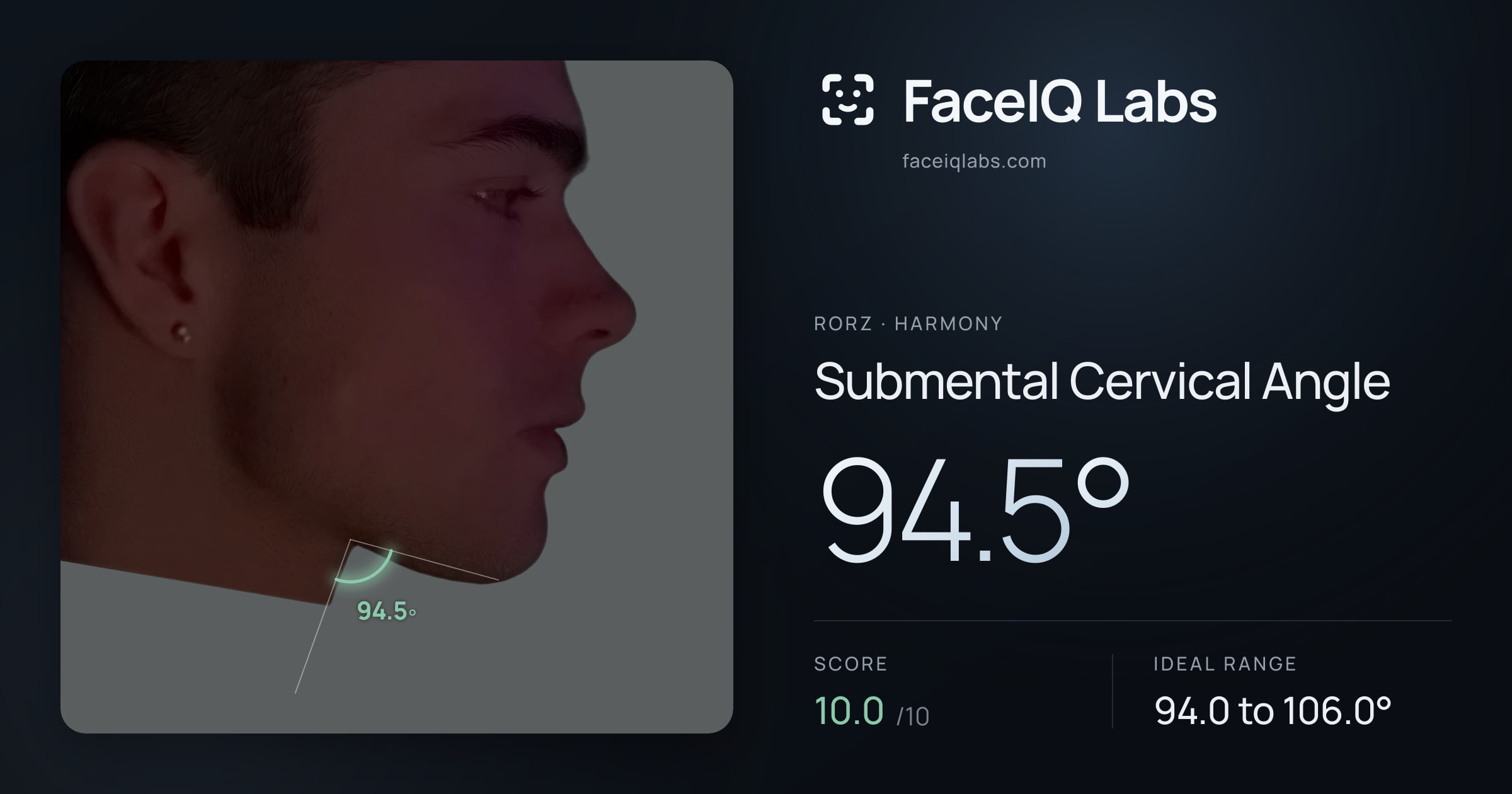 Rorz Submental Cervical Angle: 94.5°, drawn on the photo