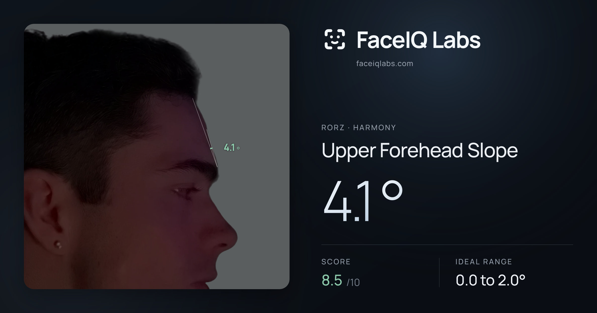 Rorz Upper Forehead Slope: 4.1°, drawn on the photo