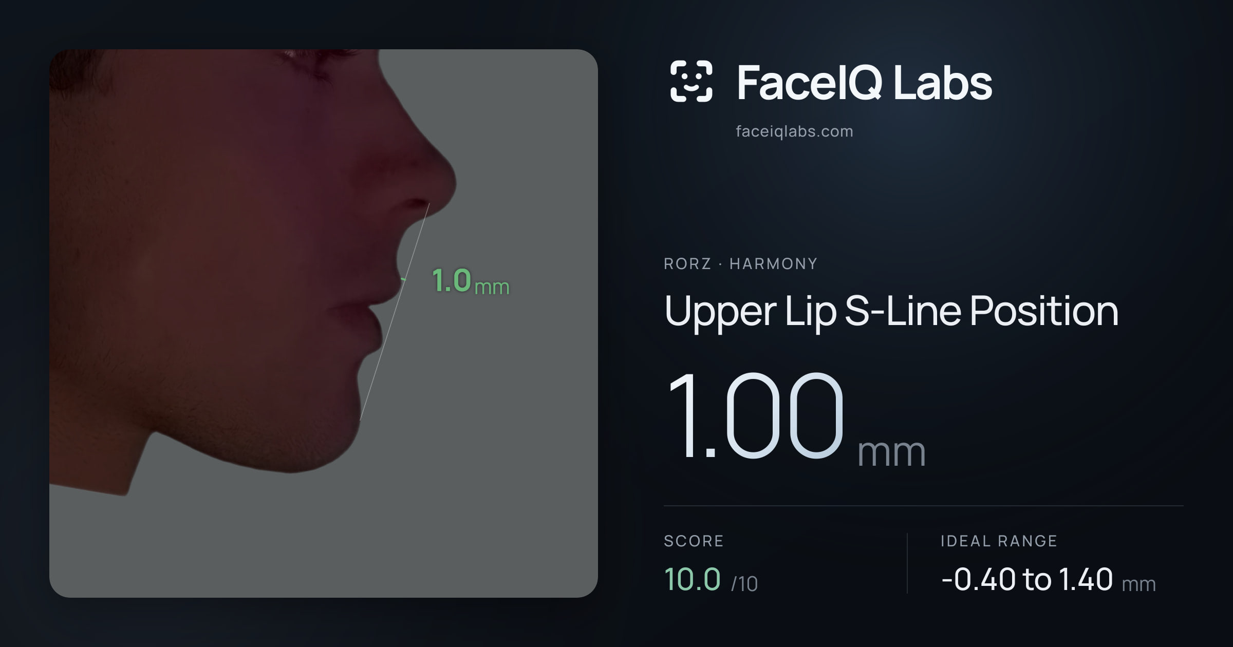 Rorz Upper Lip S-Line Position: 1.00mm, drawn on the photo