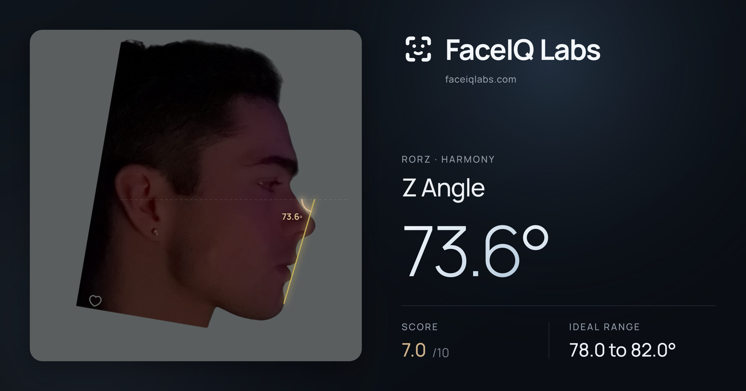 Rorz Z Angle: 73.6°, drawn on the photo