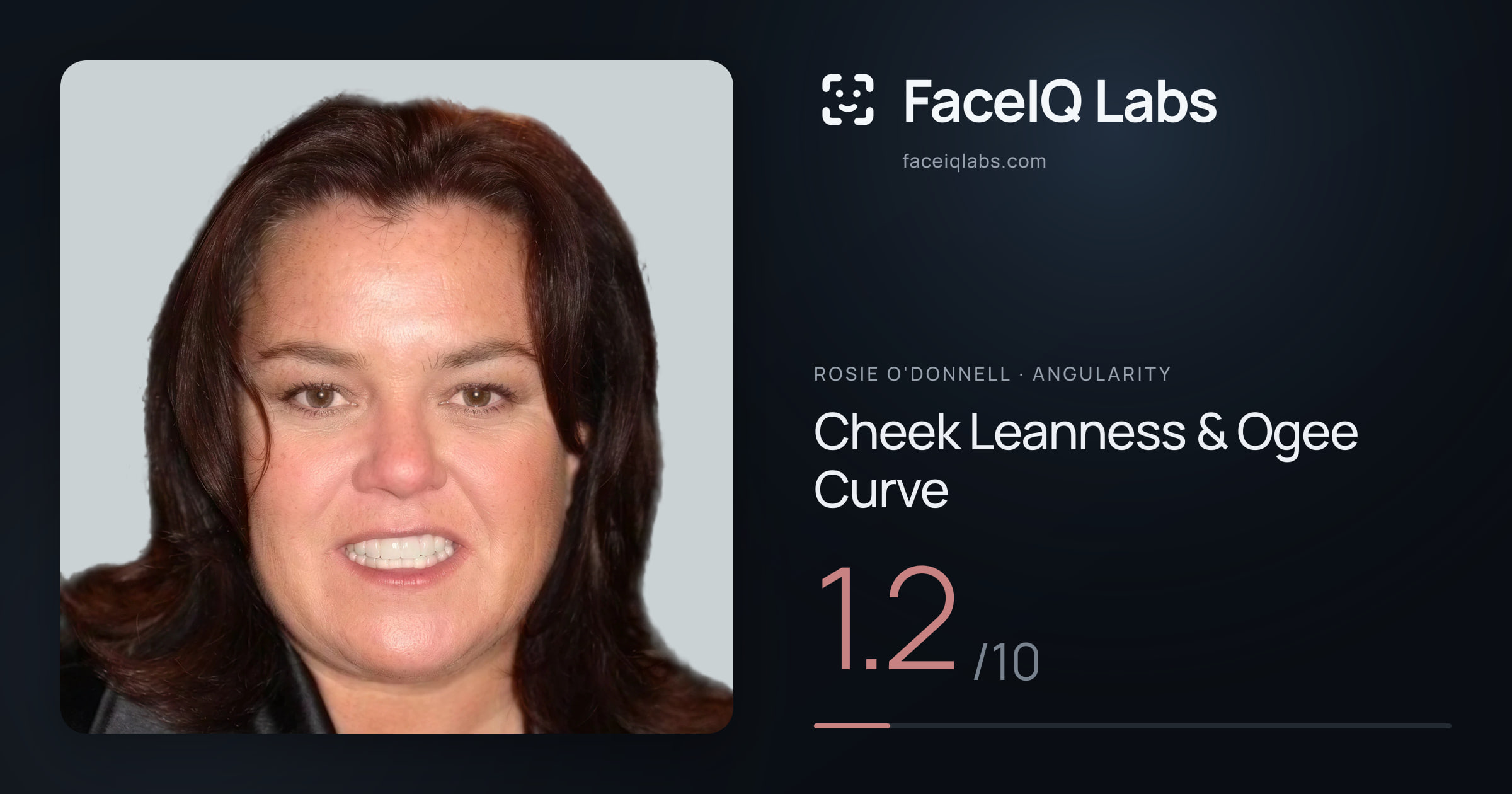 Rosie O'Donnell Cheek Leanness & Ogee Curve: 1.2/10, drawn on the photo