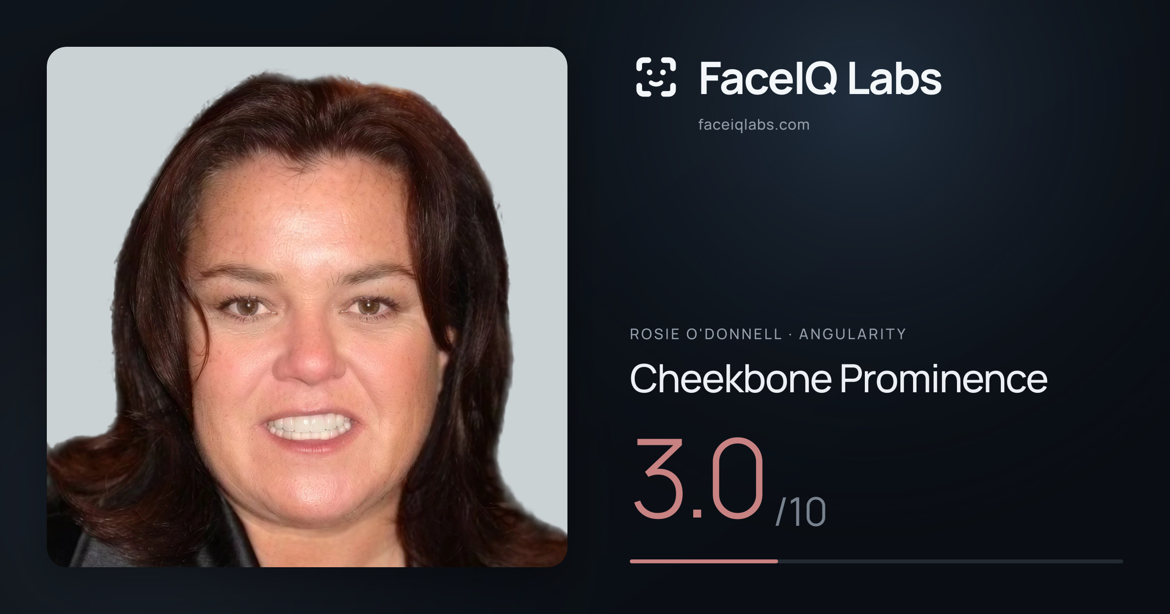Rosie O'Donnell Cheekbone Prominence: 3.0/10, drawn on the photo