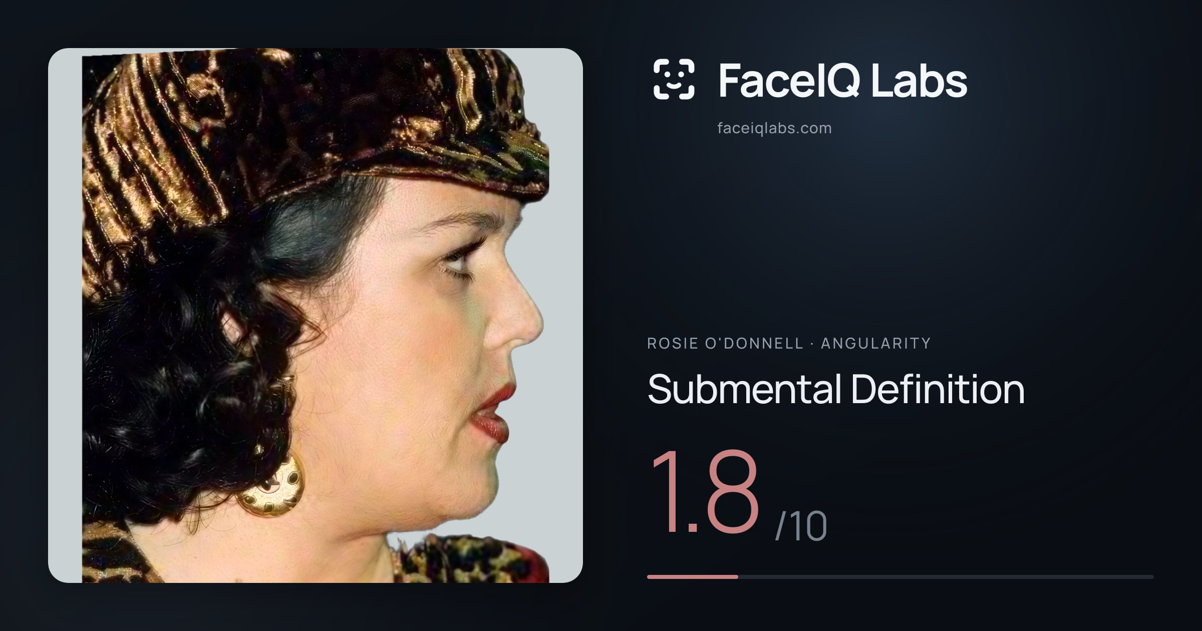 Rosie O'Donnell Submental Definition: 1.8/10, drawn on the photo