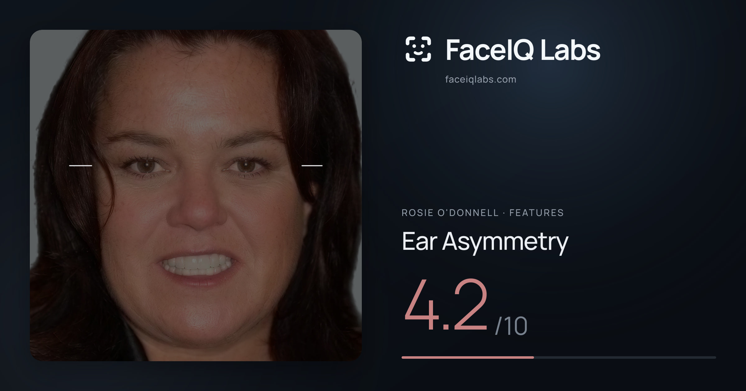 Rosie O'Donnell Ear Asymmetry: 4.2/10, drawn on the photo