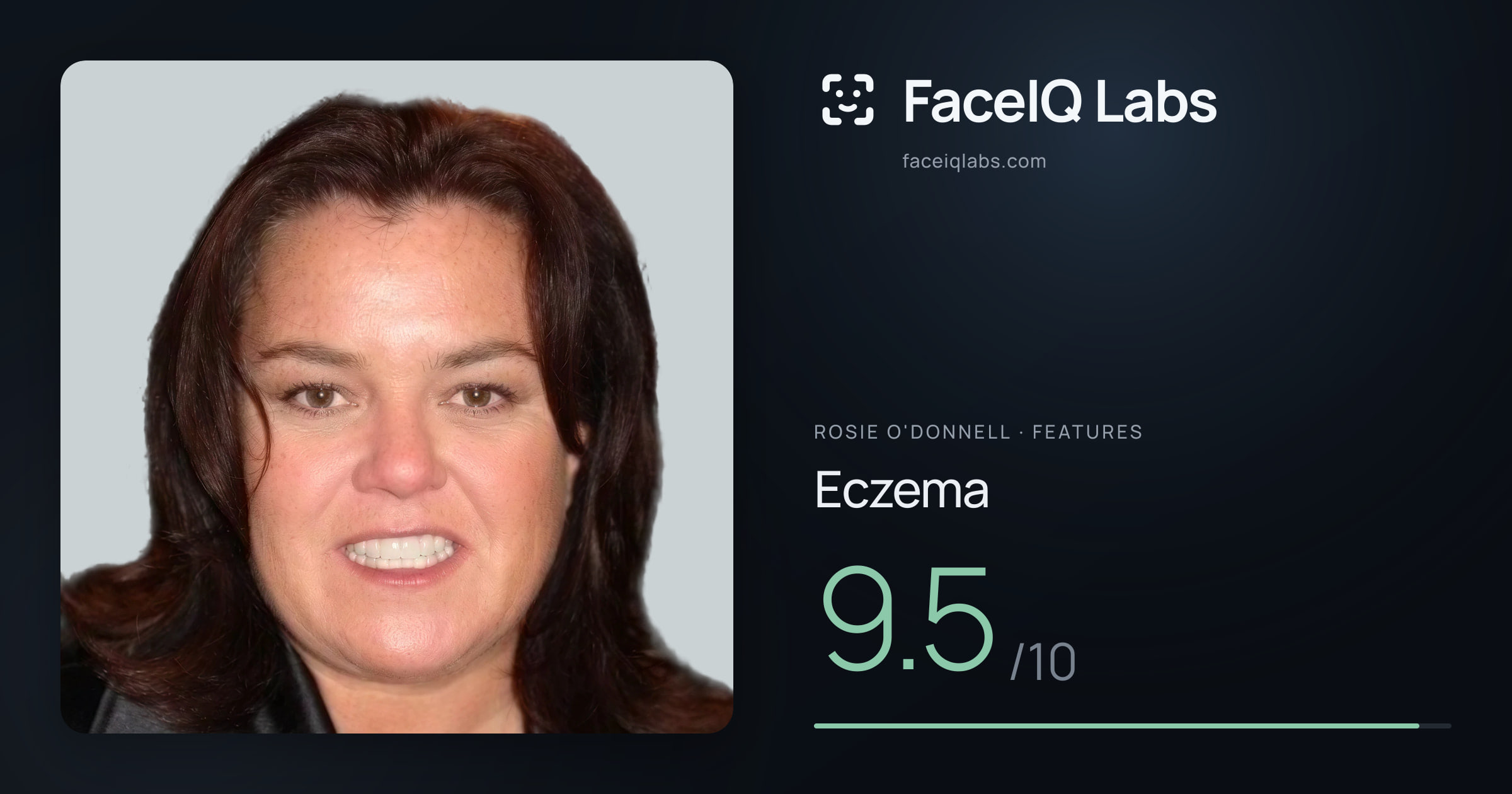 Rosie O'Donnell Eczema: 9.5/10, drawn on the photo