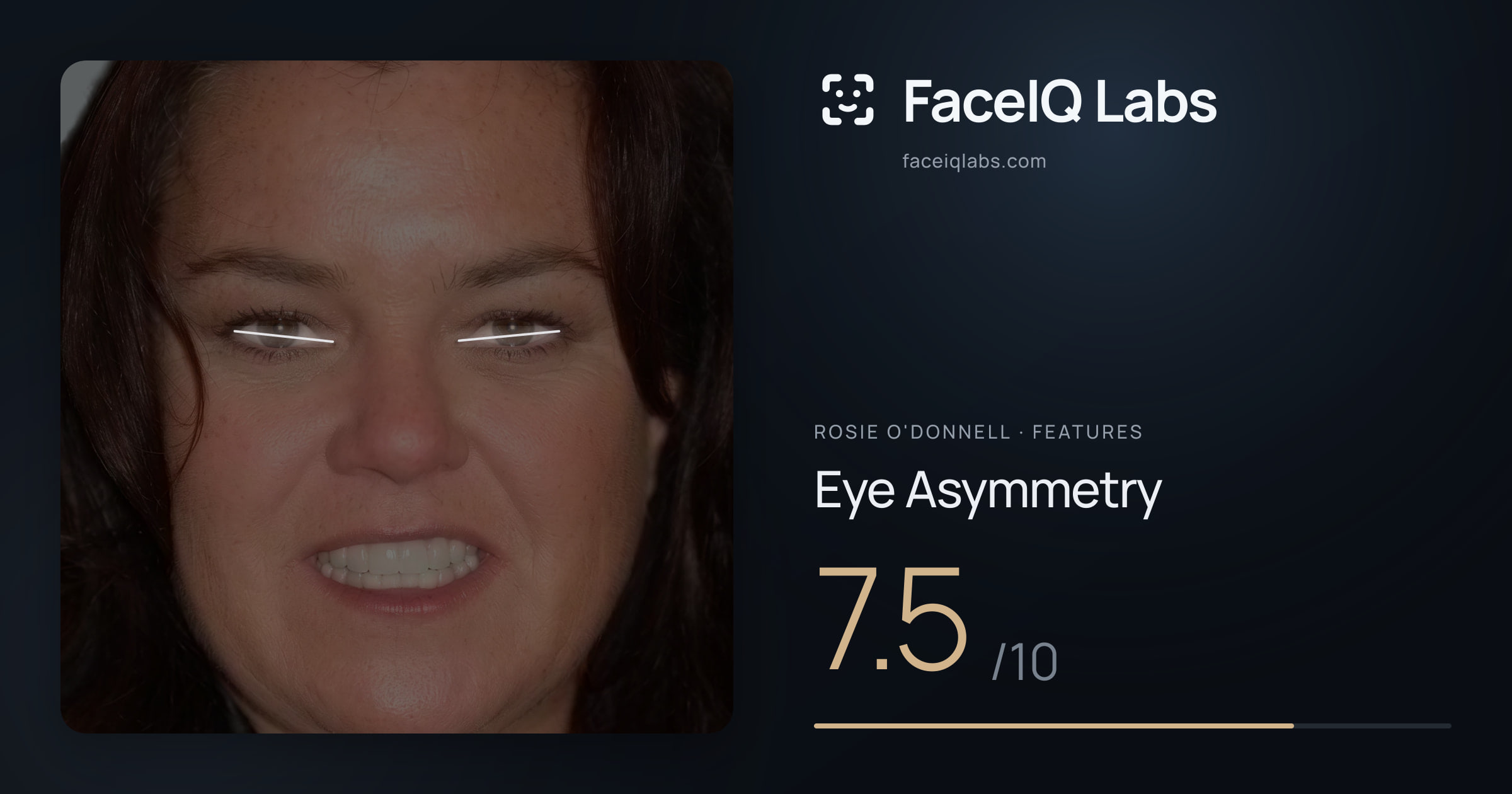 Rosie O'Donnell Eye Asymmetry: 7.5/10, drawn on the photo