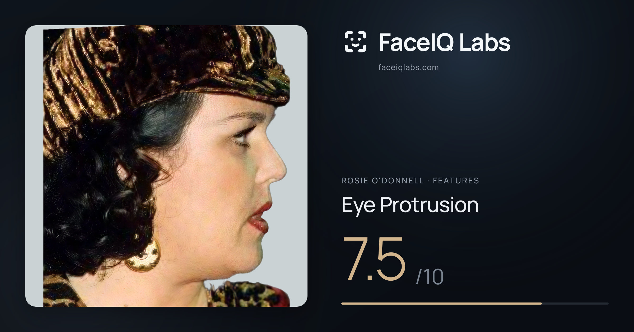 Rosie O'Donnell Eye Protrusion: 7.5/10, drawn on the photo