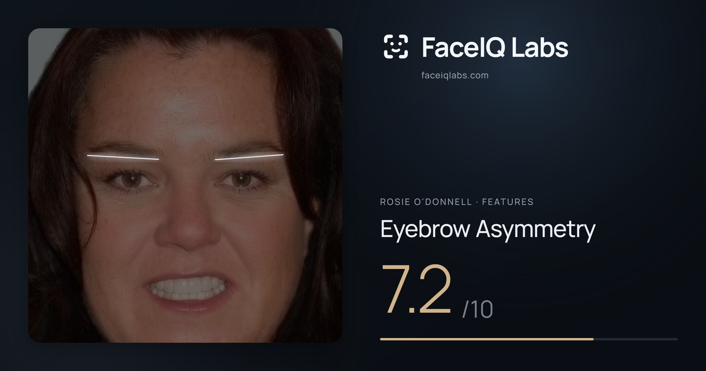 Rosie O'Donnell Eyebrow Asymmetry: 7.2/10, drawn on the photo