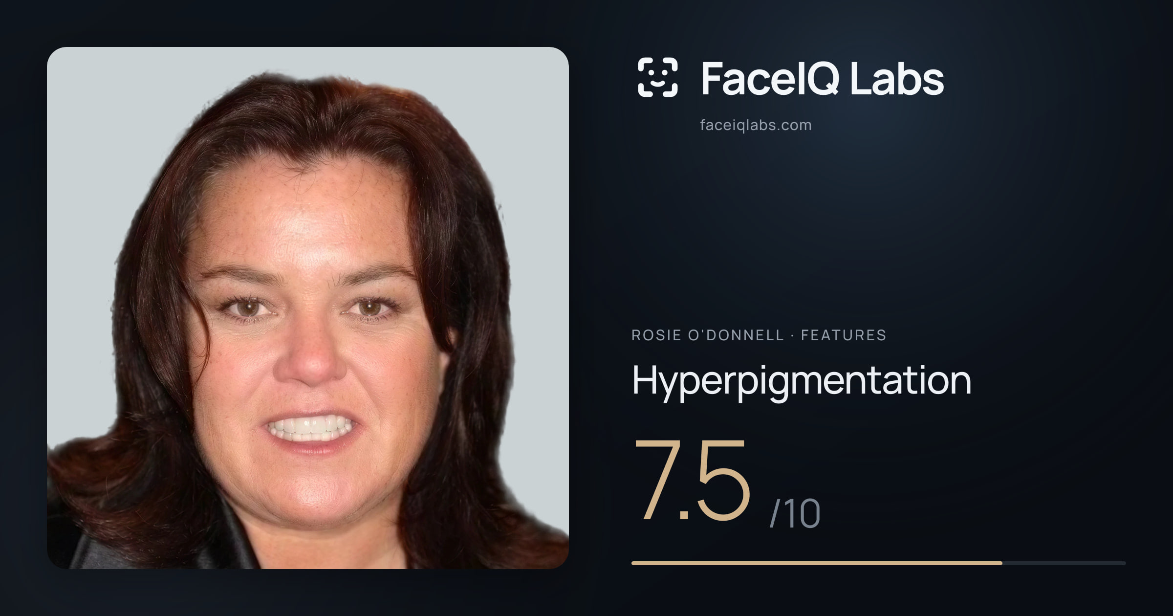 Rosie O'Donnell Hyperpigmentation: 7.5/10, drawn on the photo