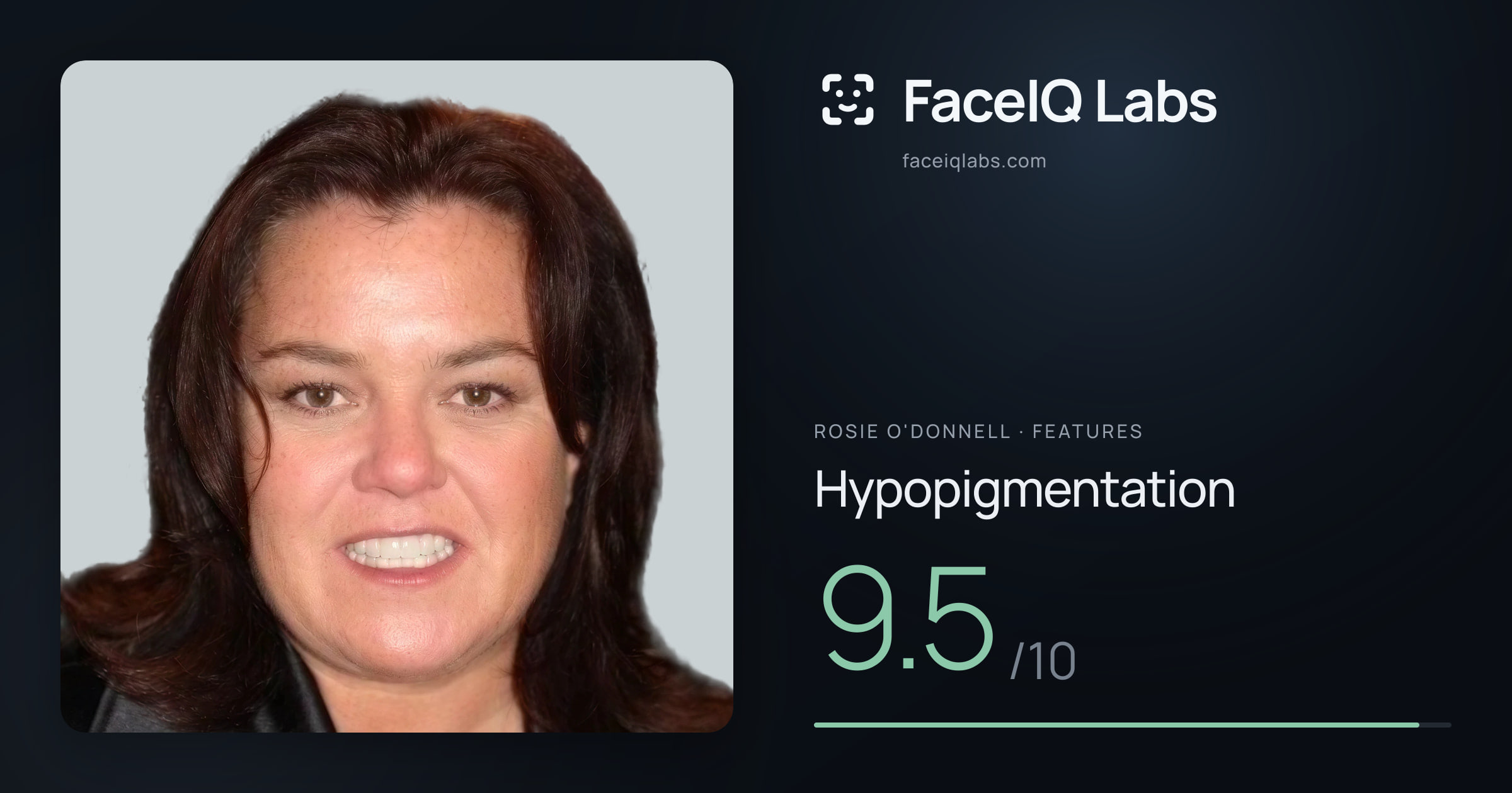 Rosie O'Donnell Hypopigmentation: 9.5/10, drawn on the photo